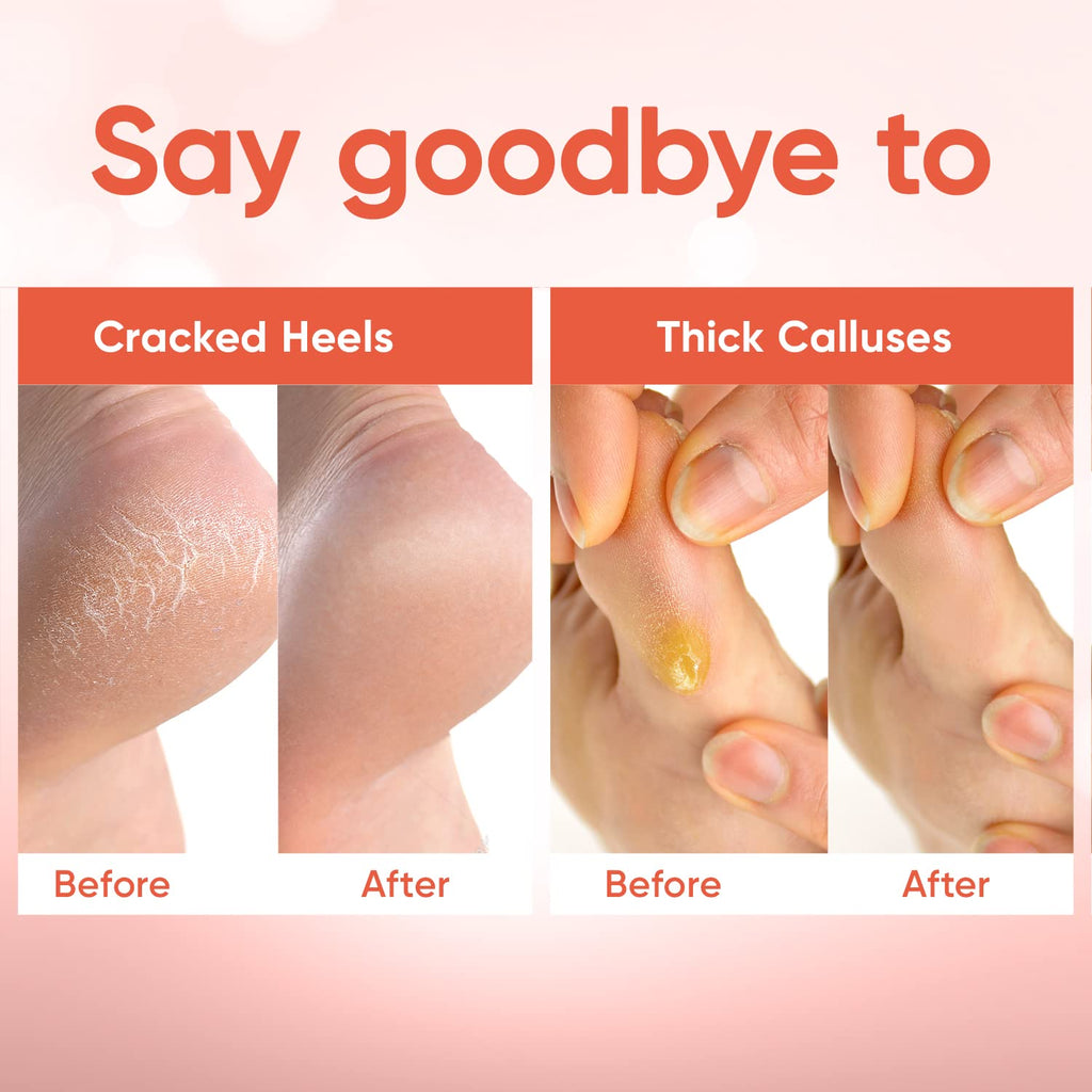 CÉLOR Foot Peel Mask – Baby Soft Feet, Aloe Vera & Lavender, 3 Pairs (Peach)