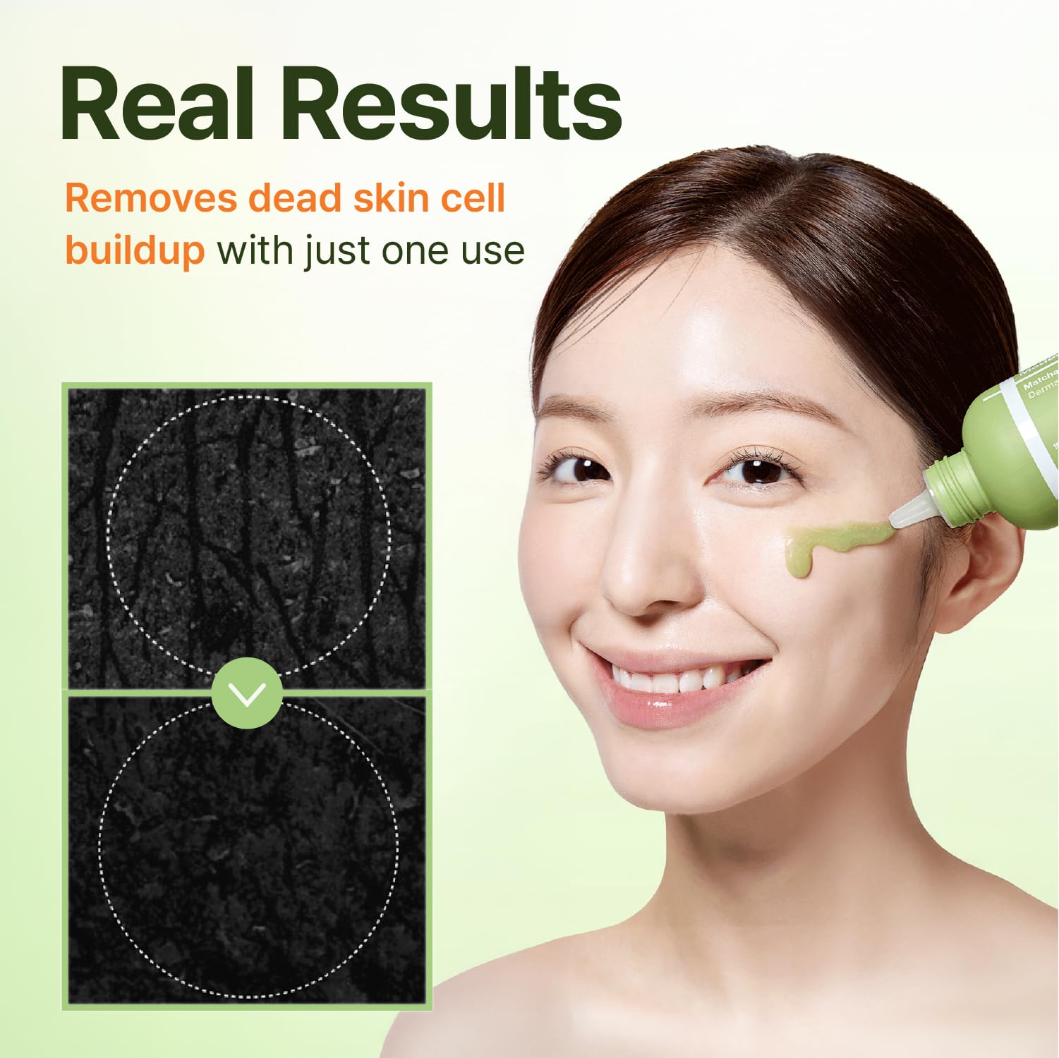 CENTELLIAN 24 Madeca Matcha Peeling Gel – Gentle Exfoliator for Face & Body (150ml)