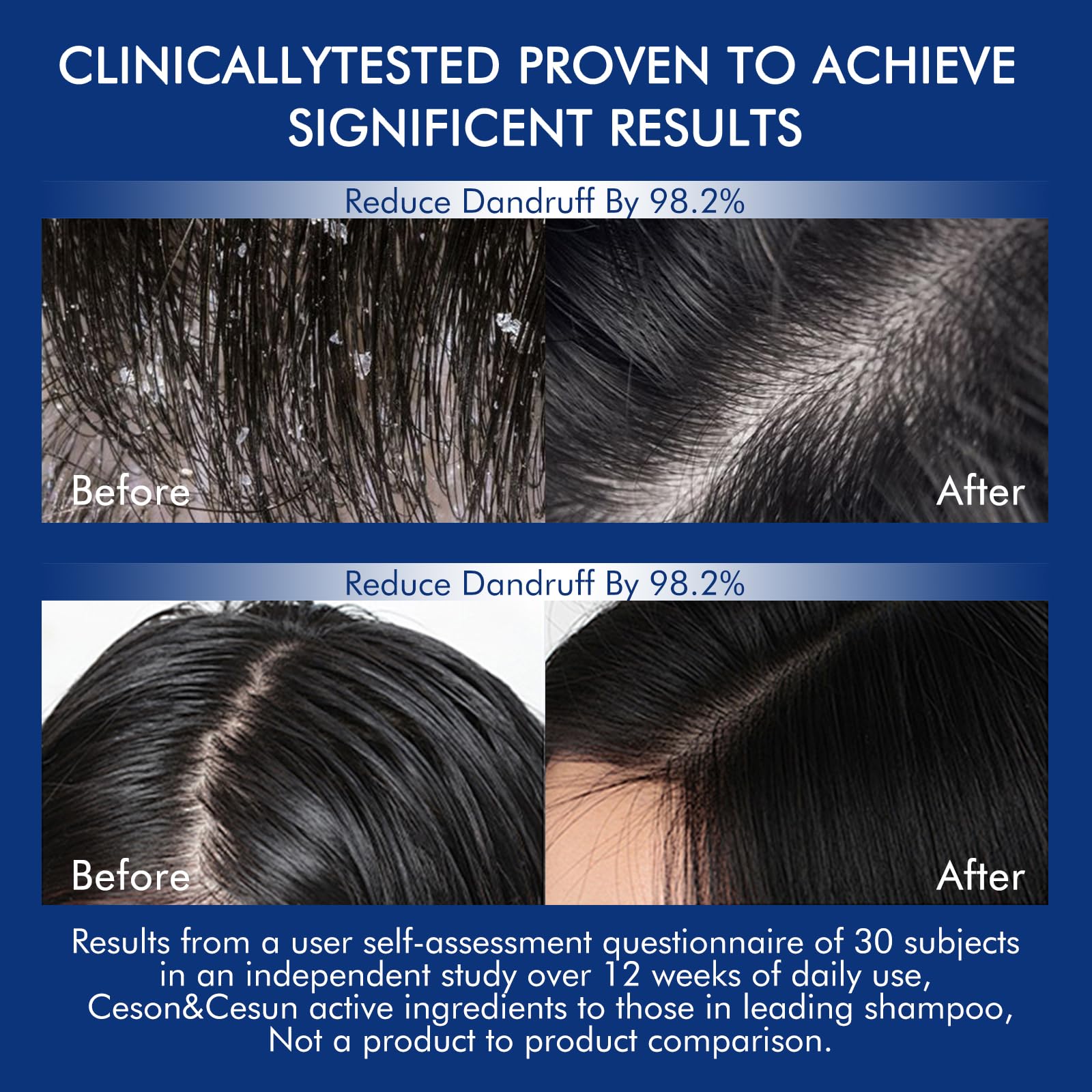 Ceson&Cesun Rosemary & Biotin Hair Growth Shampoo – Thicker, Stronger Hair for Men & Women