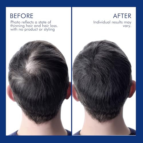 Ceson&Cesun Rosemary & Biotin Hair Growth Shampoo – Thicker, Stronger Hair for Men & Women