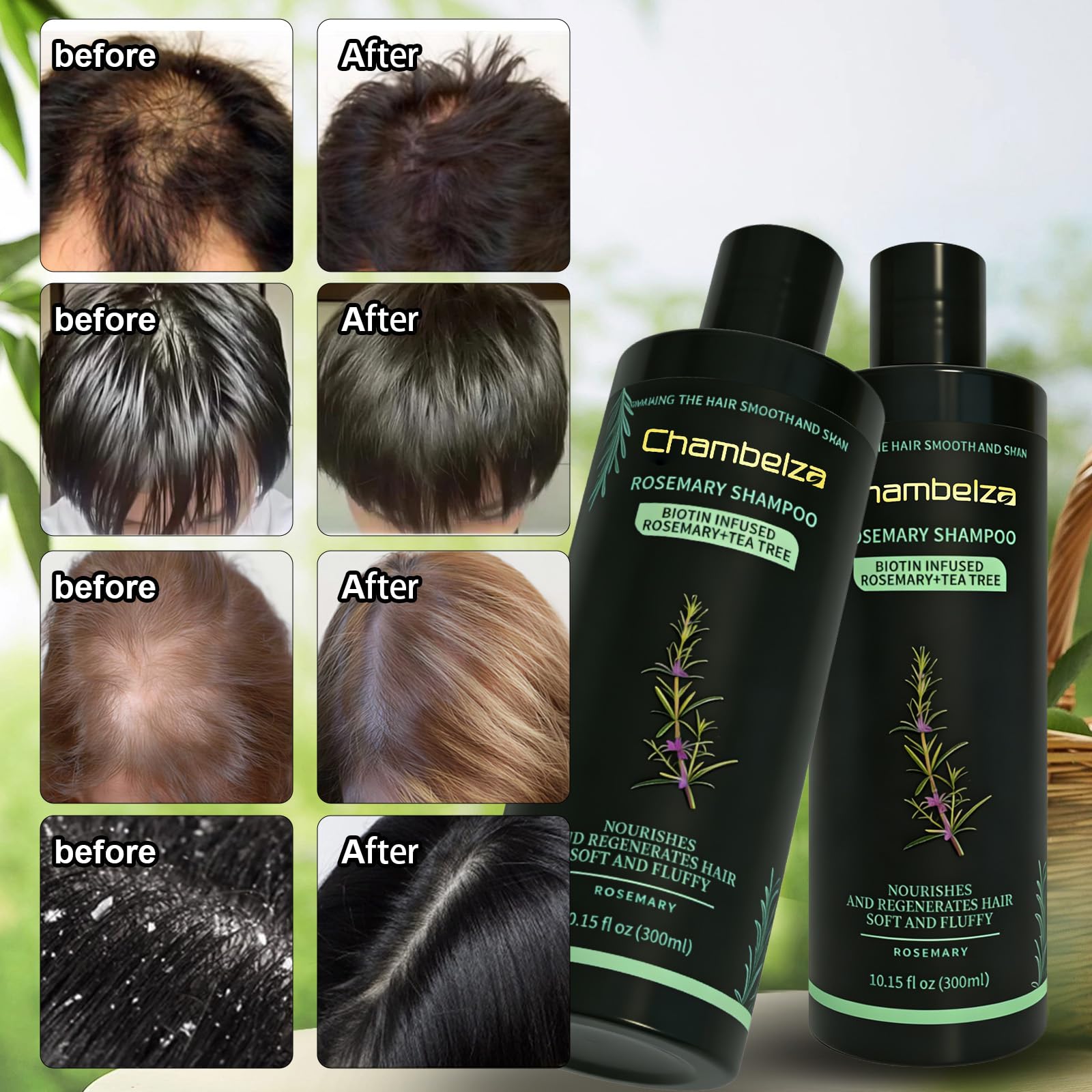 Chambelza Organic Rosemary Hair Growth Shampoo for Men and Women – Biotin & Hydrolyzed Keratin, 2-Pack