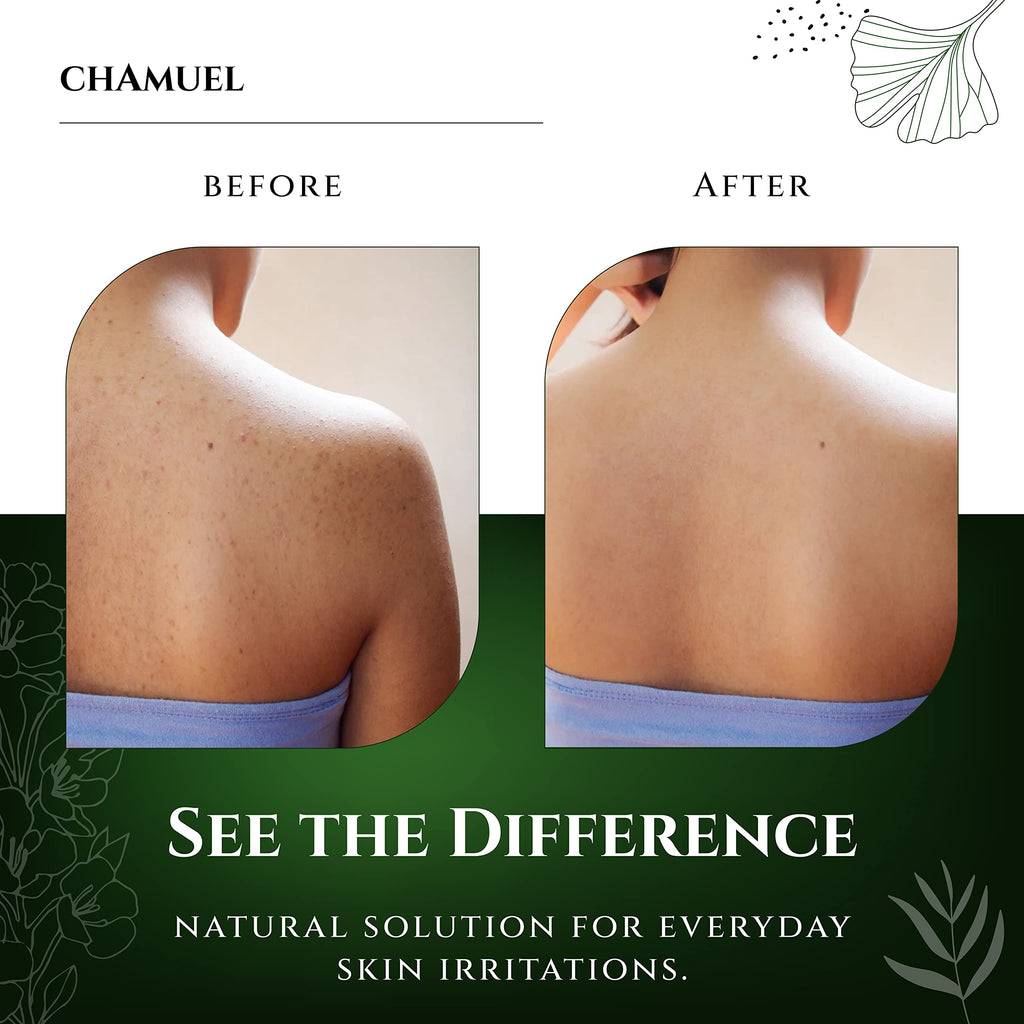 Chamuel Tea Tree Body Wash – 100% Natural, Gentle Cleanse for All Skin Types (11.8 oz)