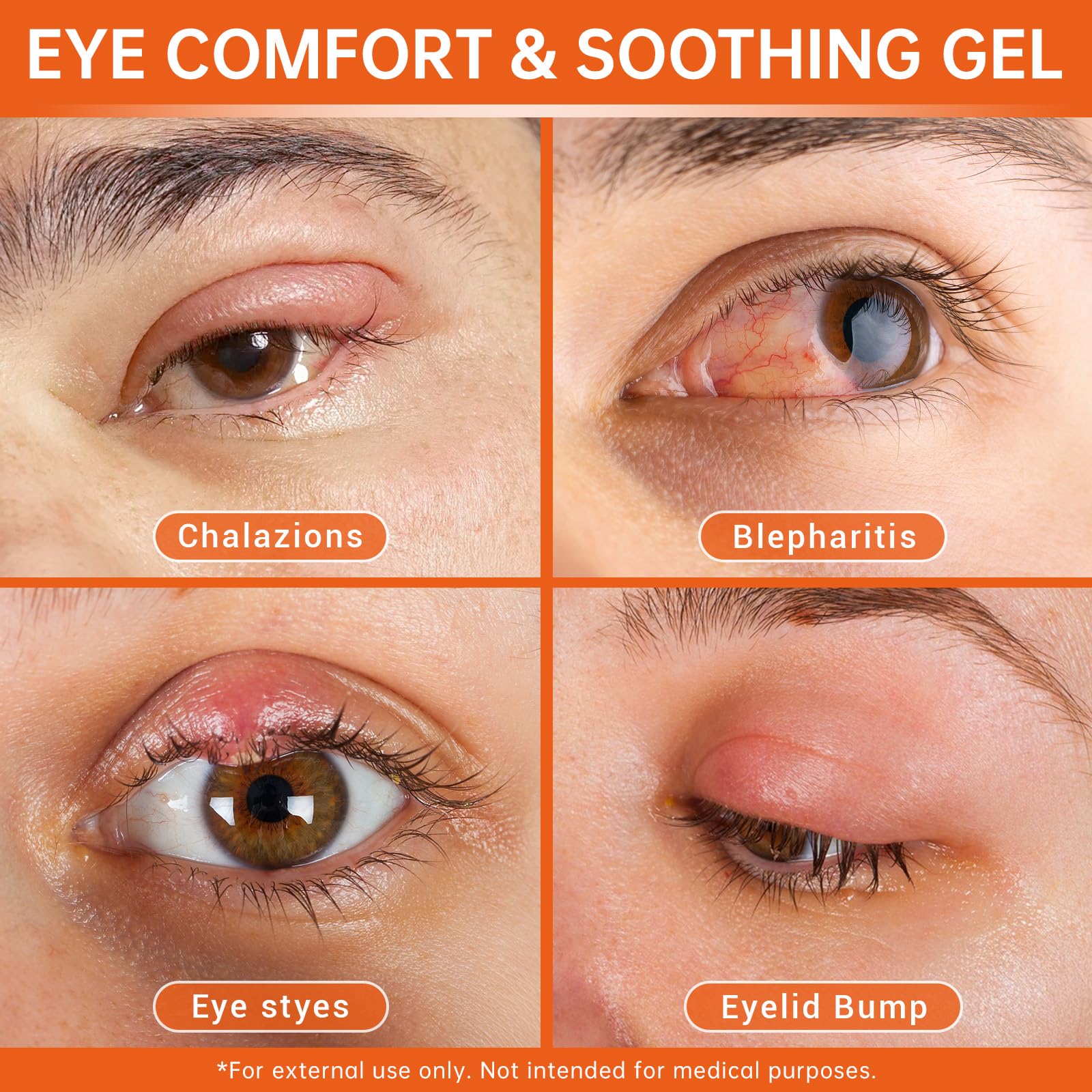 CHANGARLOAD Stye Eye Relief Gel with Tea Tree Oil, Calendula & Vitamin E – 2-Pack (1.4oz)