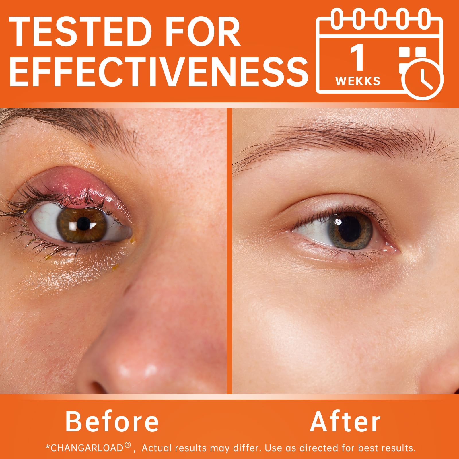 CHANGARLOAD Stye Eye Relief Gel with Tea Tree Oil, Calendula & Vitamin E – 2-Pack (1.4oz)