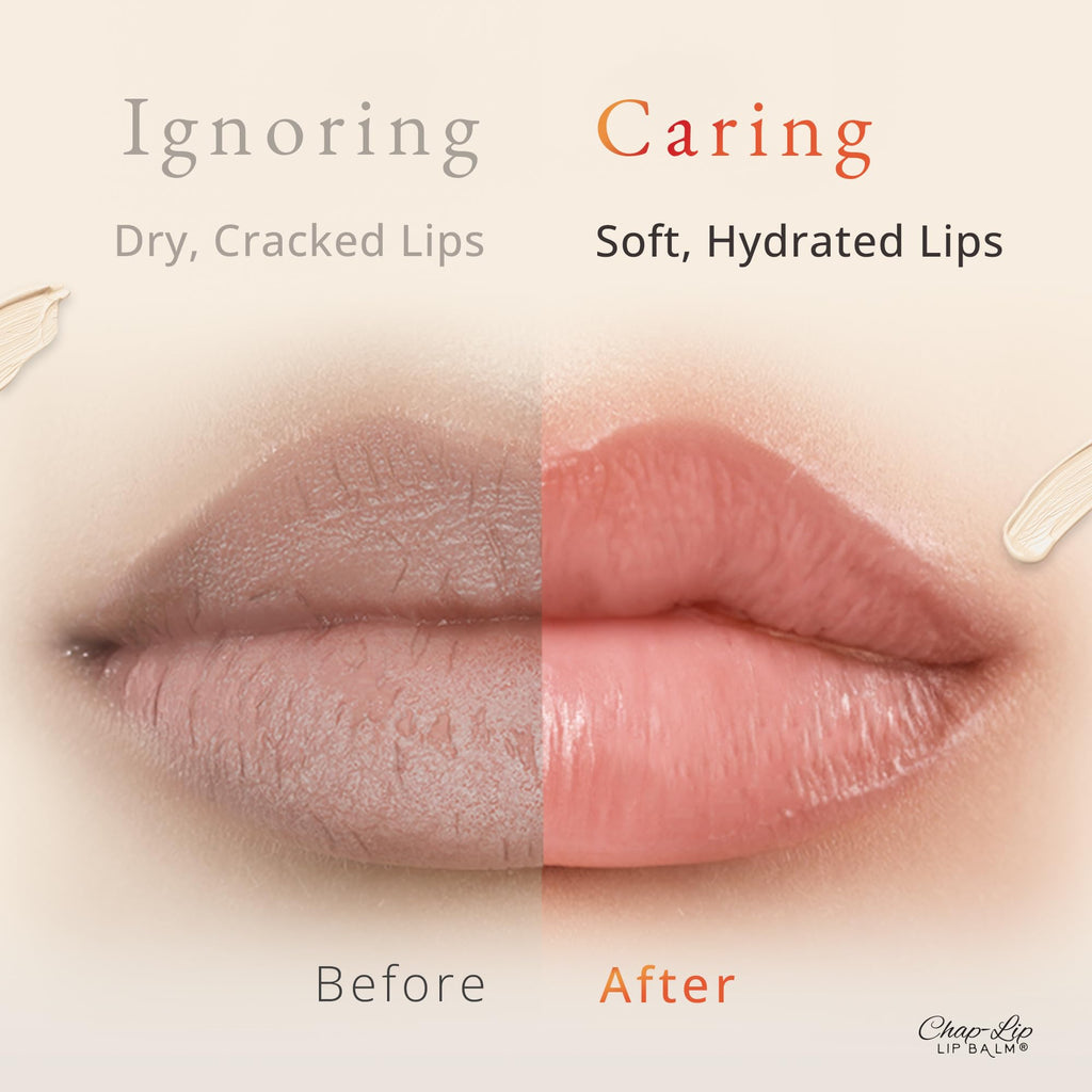 CHAP-LIP Original Lip Balm Bulk Pack – Hydrating Fruit Flavors, USA Made