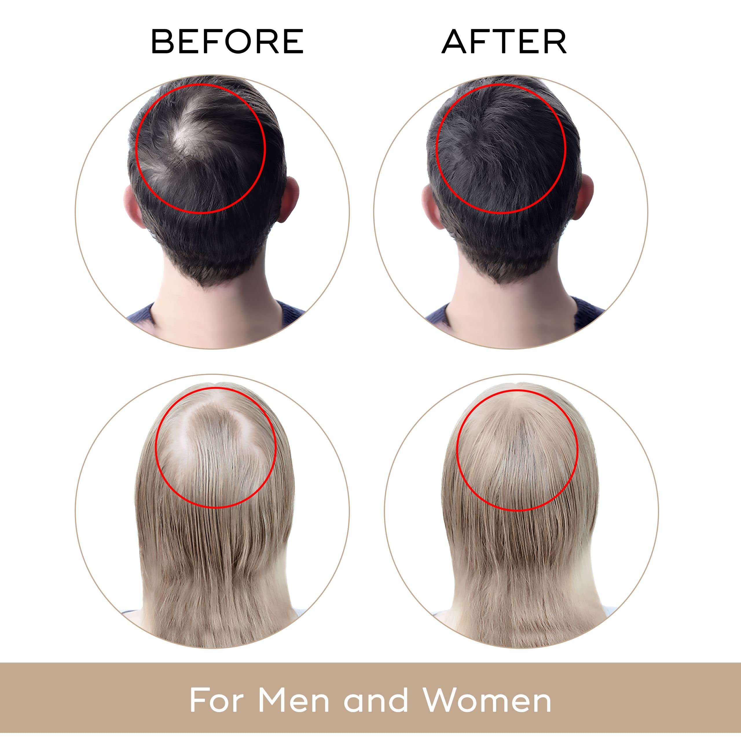 Charismo USA Dekohair Regrowth Serum — Stops Thinning, Boosts Root Volume