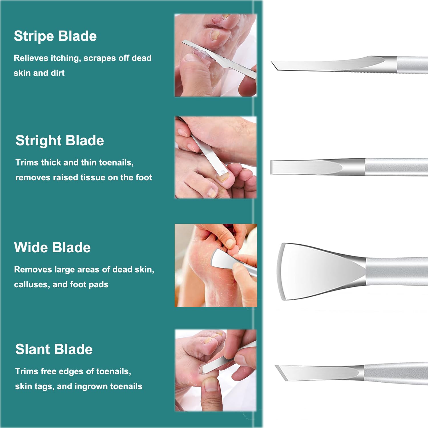 CHICREEN Ingrown Toenail Removal Kit – 4-Piece Stainless Steel Pedicure Tools