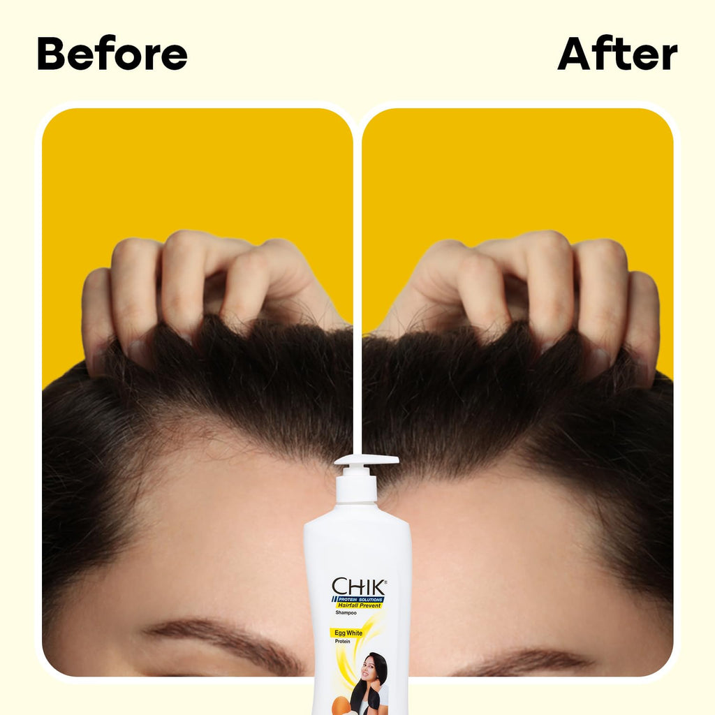 Chik Hairfall Prevent Egg Shampoo 340ml – Nourishing Egg White Protein