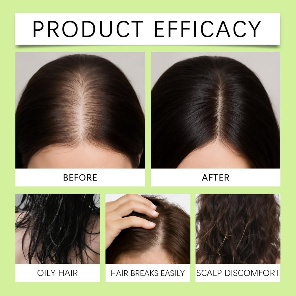 ChLNDalin Alpha Infuse Hair Regrowth System | Herbal Nourishment