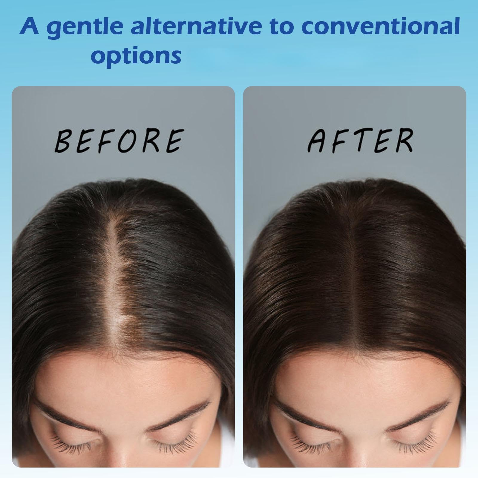 ChLNDalin Hair Growth Roll-On Serum – Rosemary, Redensyl, AnaGain, Biotin & Niacinamide