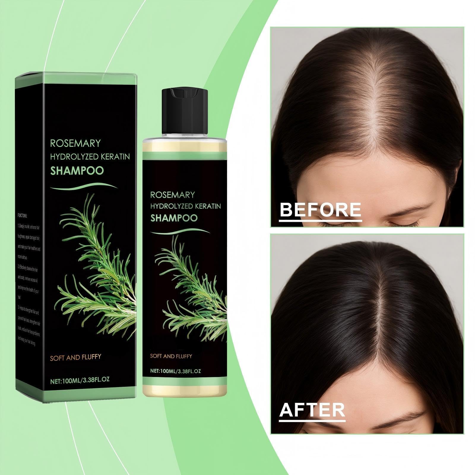 ChLNDalin Rosemary Hair Growth Shampoo with Hydrolyzed Keratin – Nourishes & Regenerates (Pack of 2)