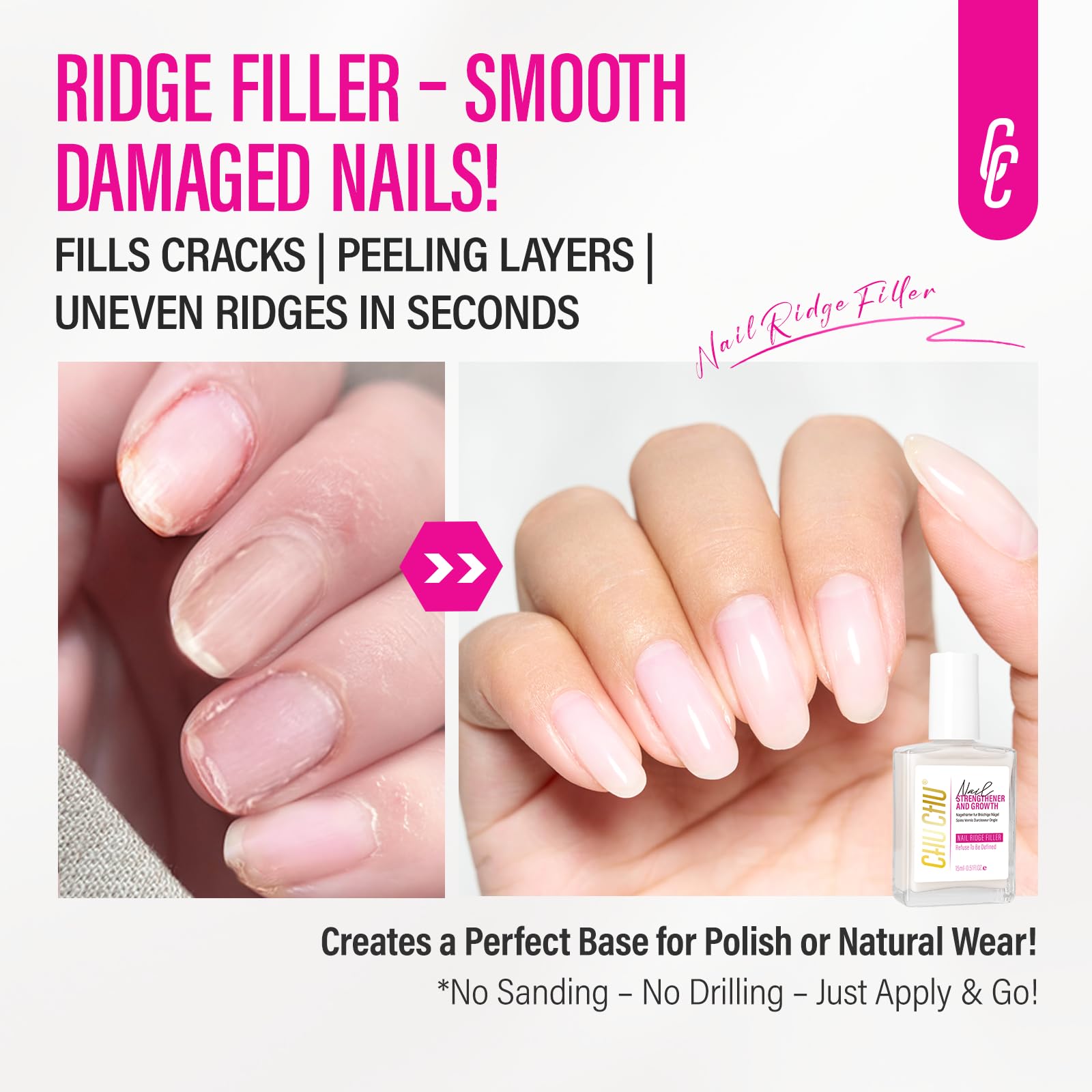 CHUCHU Nail Ridge Filler – 15ml Milky White Nail Strengthener & Growth for Weak Nails