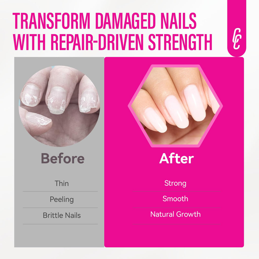 CHUCHU Nail Ridge Filler – 15ml Milky White Nail Strengthener & Growth for Weak Nails