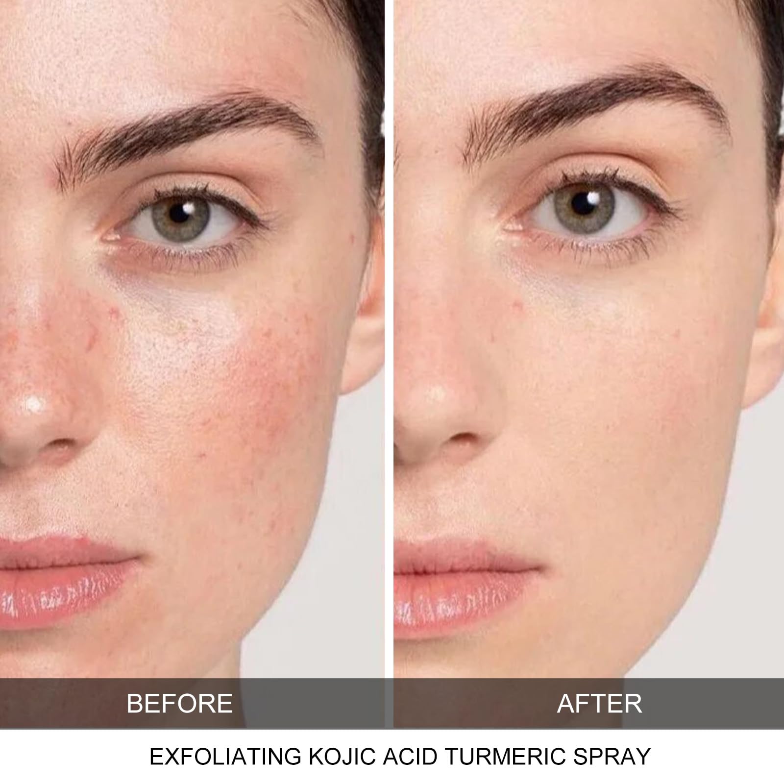 CHZHEN Keratin Care Kojic Acid Turmeric Spray – Gentle Exfoliating Brightening for Face & Body