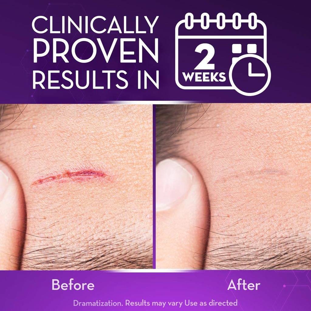 Cicatricure Advanced Scar Gel for Face & Body – Clinically Proven Results in 2 Weeks