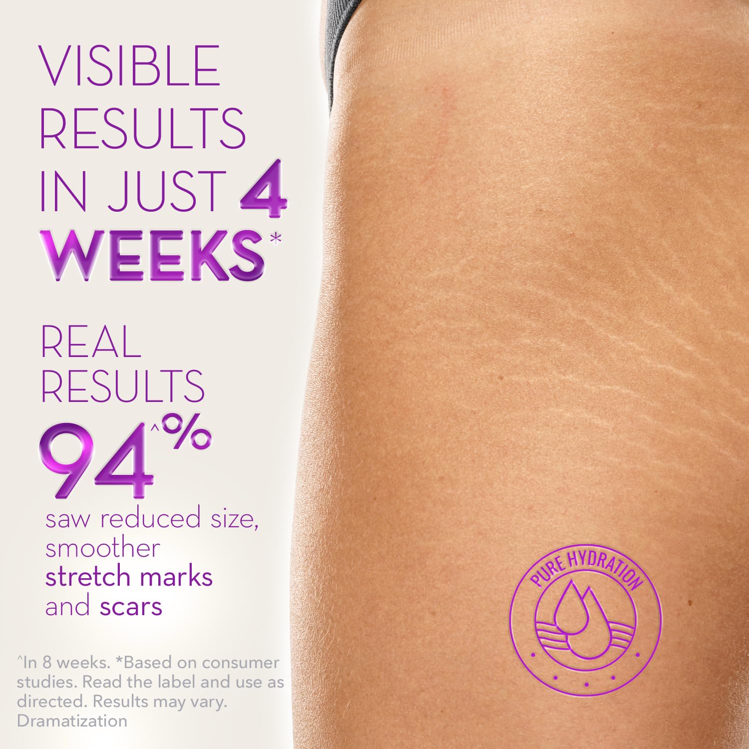 Cicatricure Cica Oil for Stretch Marks & Scars – Fast-Absorbing Body Oil with Vitamin E (6.7 fl oz)