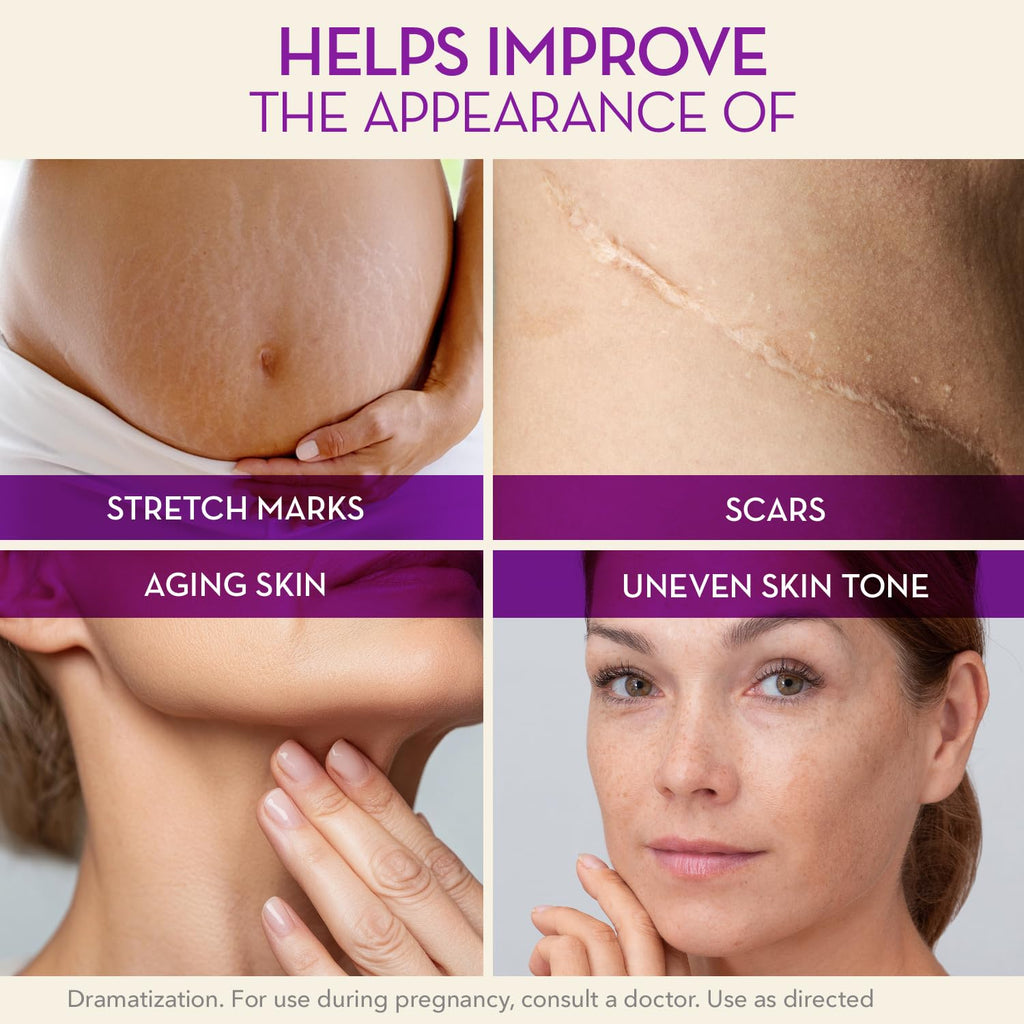 Cicatricure Cica Oil for Stretch Marks & Scars – Fast-Absorbing Body Oil with Vitamin E (6.7 fl oz)
