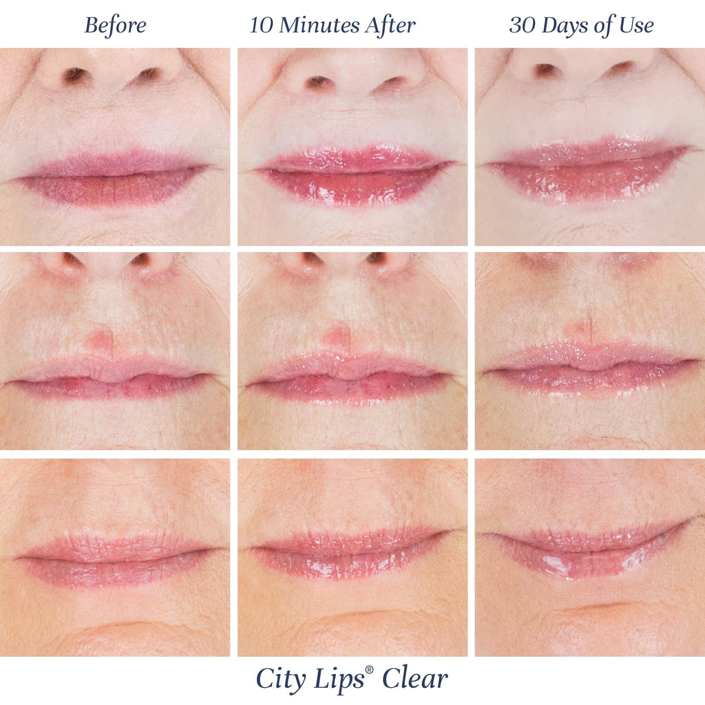City Lips Clear by City Beauty | Plumping Lip Gloss with Hyaluronic Acid & Peptides (Pack of 3, Cruelty-Free)