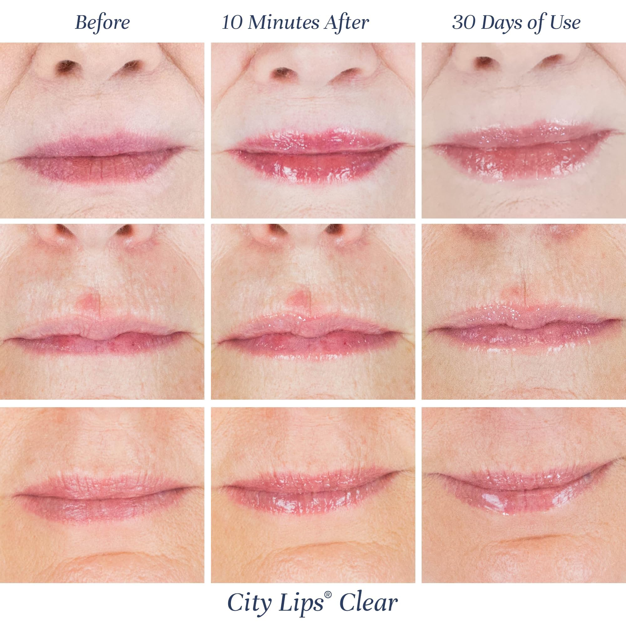 City Lips Clear by City Beauty | Plumping Lip Gloss with Hyaluronic Acid & Peptides (Pack of 3, Cruelty-Free)