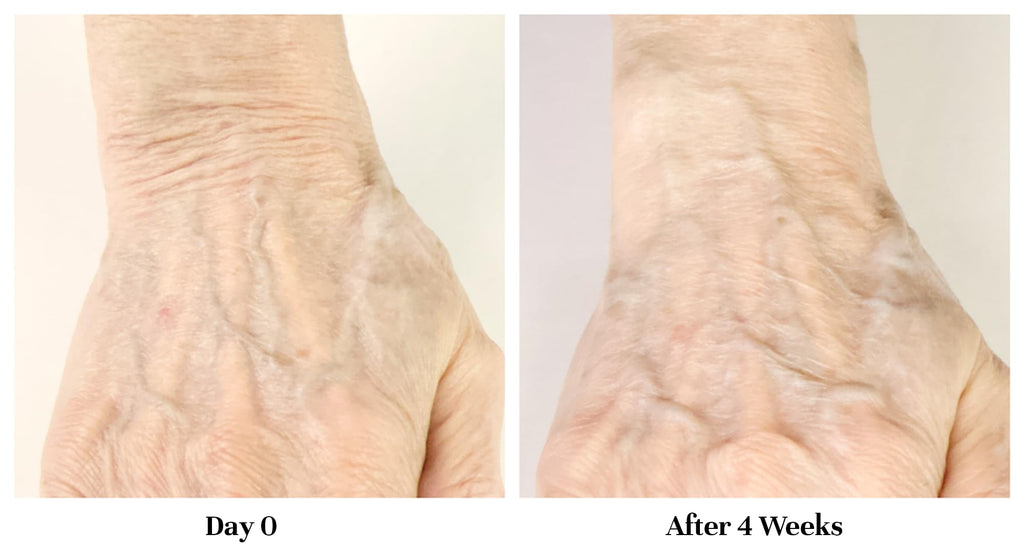 City Beauty Restoring Hand Treatment – Anti-Aging Hand Cream with Wash-Resistant Hydration