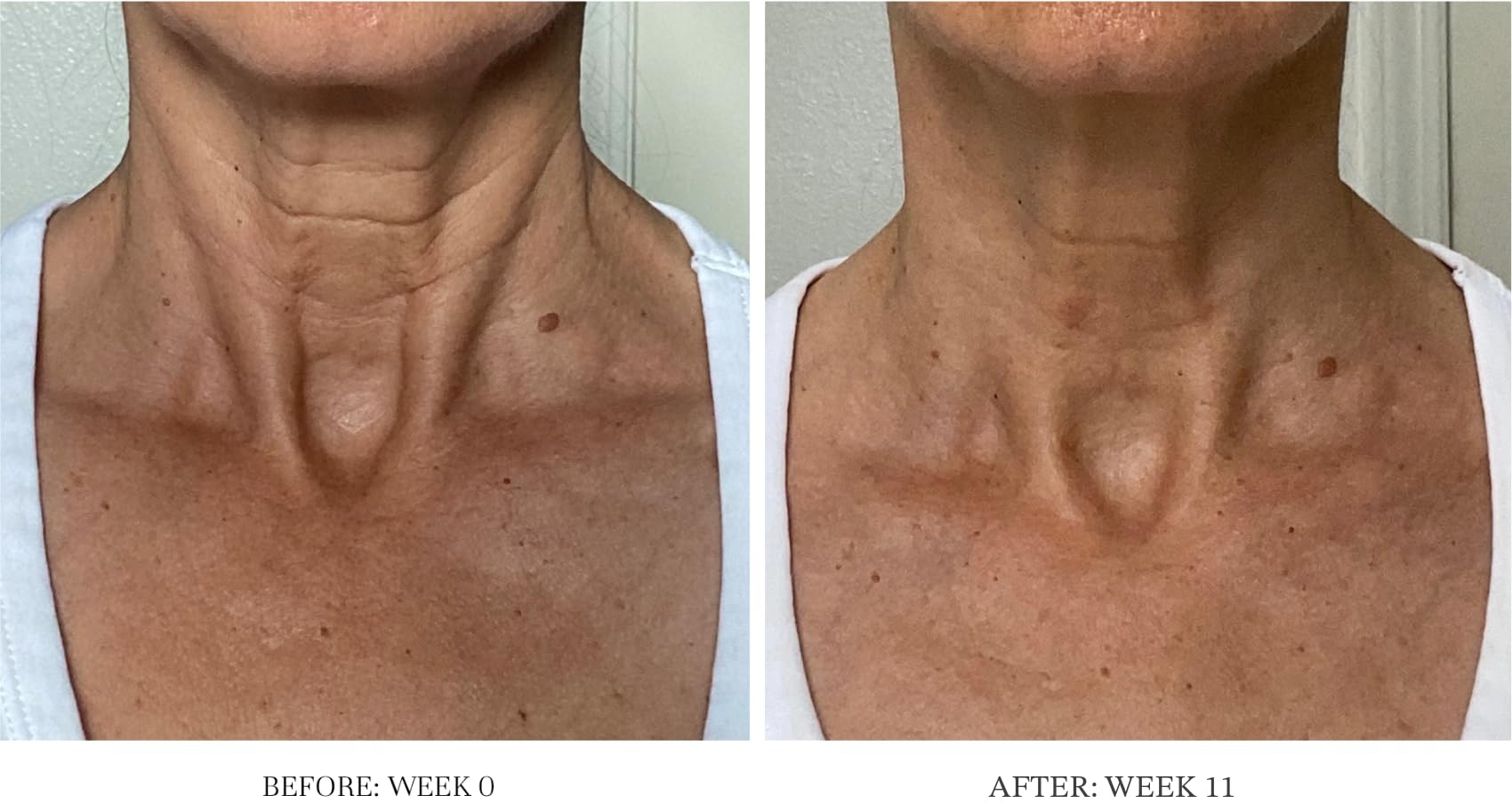 City Beauty Ultra-Firming Dry Oil – Neck & Décolletage Lift & Hydration