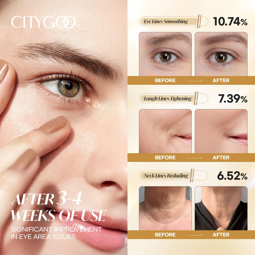 CITYGOO Retinol Eye Stick Hydrating - Anti-Aging Eye Care with Retinol & Collagen | Travel-Friendly 0.35oz/10g