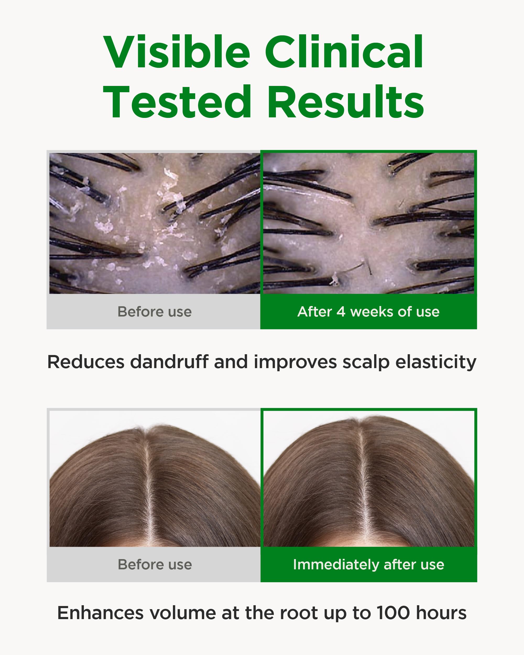 CKD Guaranteed Amino Biotin All-Powerful Treatment – Silicone-Free Deep Care Conditioner