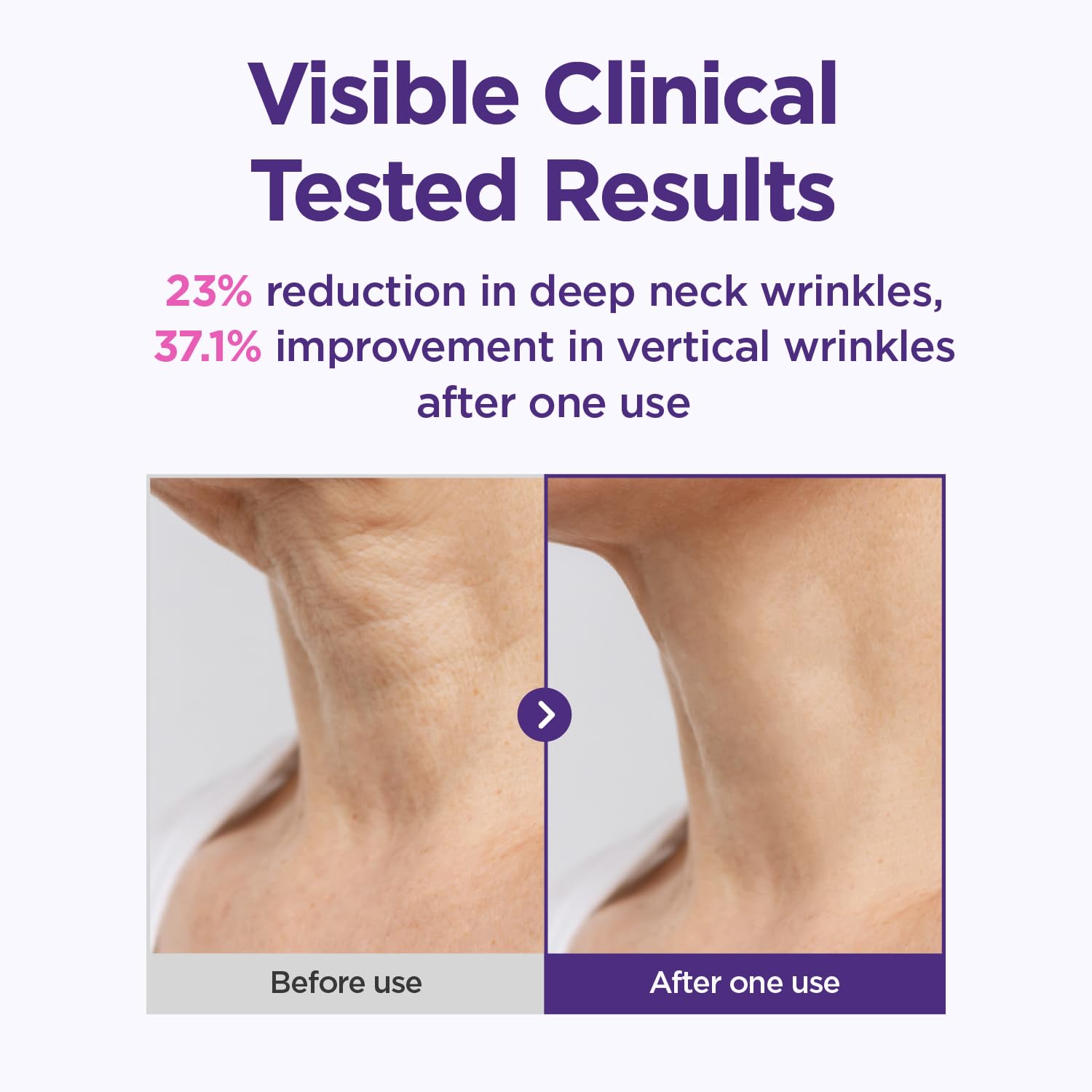 CKD Gua Sha Neck Cream Filltocshot – Advanced Neck Firming with Massage Roller