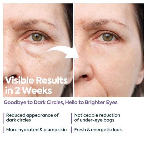 Clasy Care Under Eye Cream – Dark Circles & Puffiness, 5% Caffeine + 2% Hyaluronic Acid