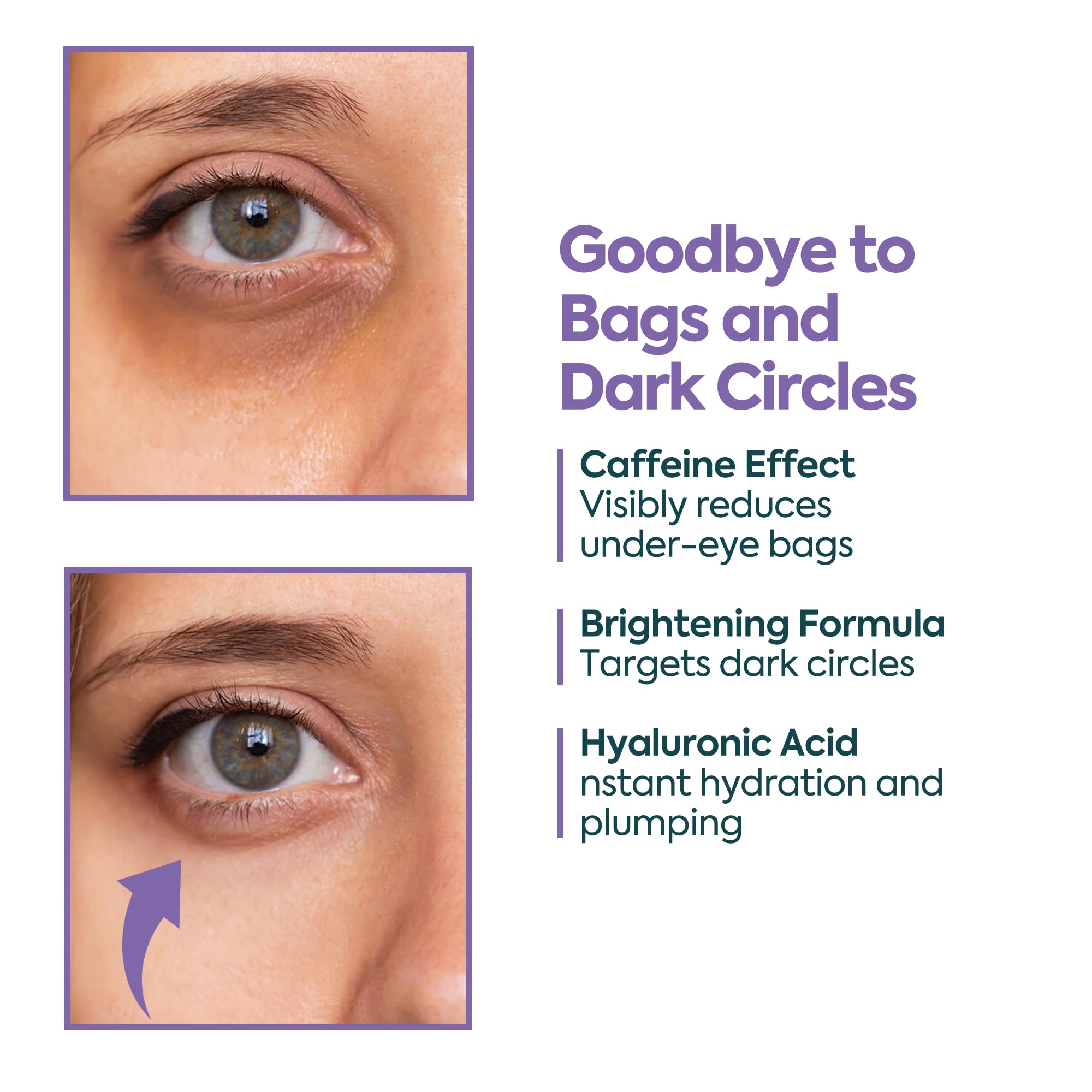 Clasy Care Under Eye Cream – Dark Circles & Puffiness, 5% Caffeine + 2% Hyaluronic Acid