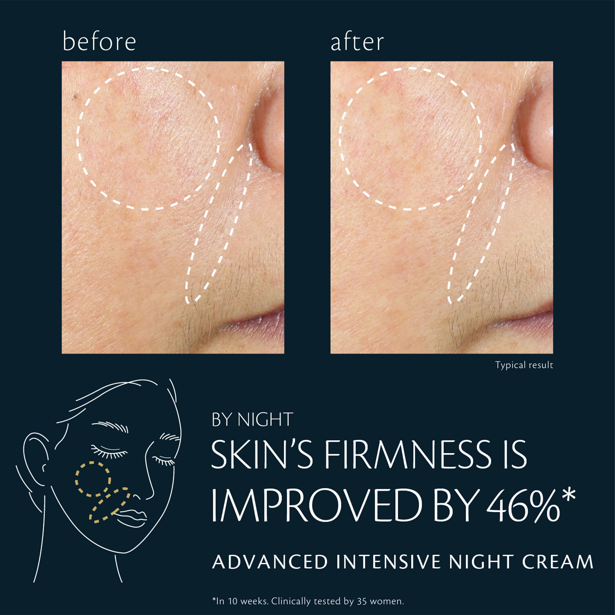 Clé de Peau Beauté Advanced Intensive Night Cream – Deep Hydration Overnight Renewal