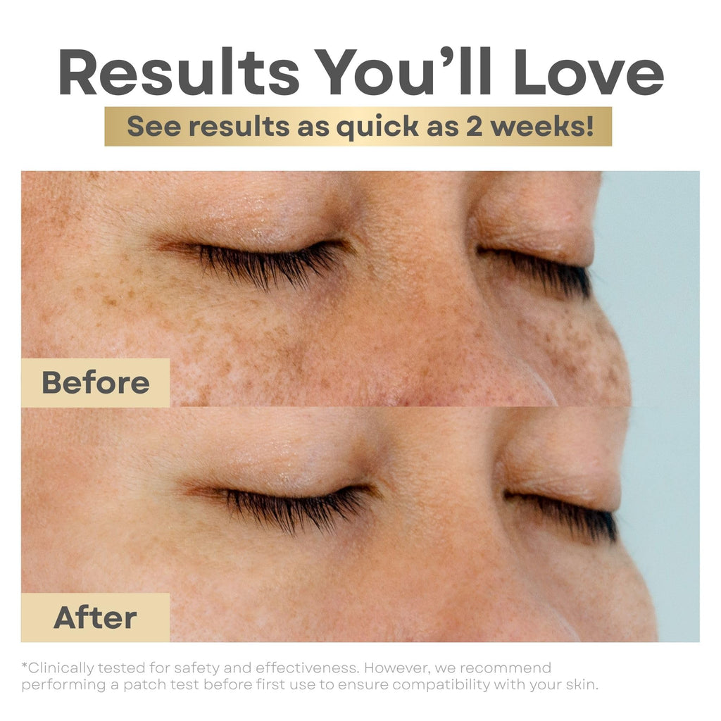Clear Essence Lemon Plus Vitamin C Serum for Face – Hydroquinone-Free Brightening & Even Tone