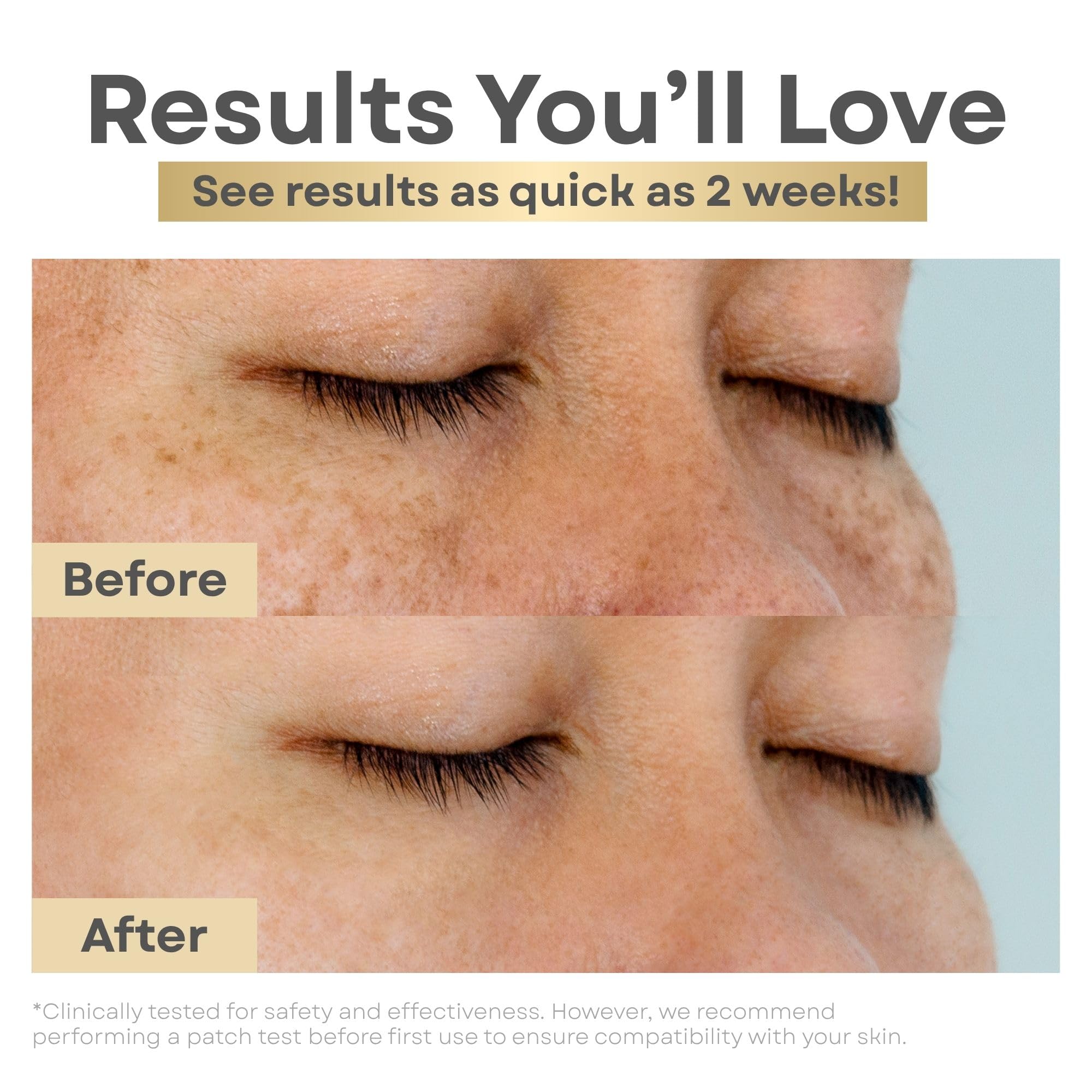 Clear Essence Lemon Plus Vitamin C Serum for Face – Hydroquinone-Free Brightening & Even Tone