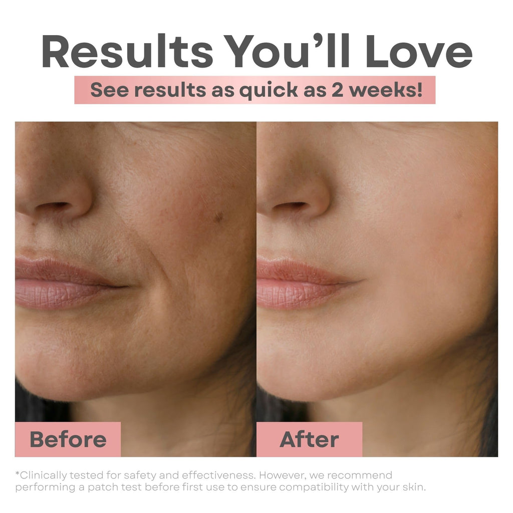 Clear Essence Skin Lightening Serum 1.7oz | Vitamin C Brightening, Dark Spot & Hyperpigmentation Corrector