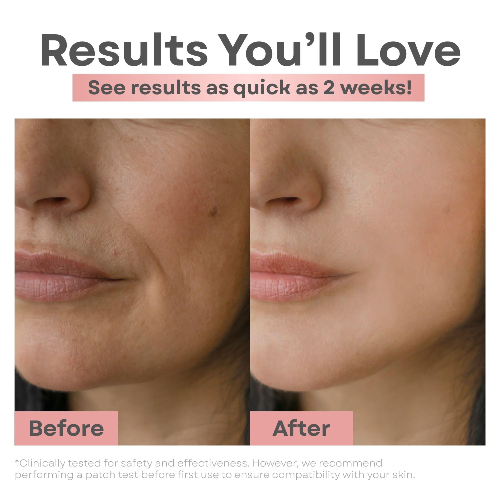 Clear Essence Skin Lightening Serum 1.7oz | Vitamin C Brightening, Dark Spot & Hyperpigmentation Corrector