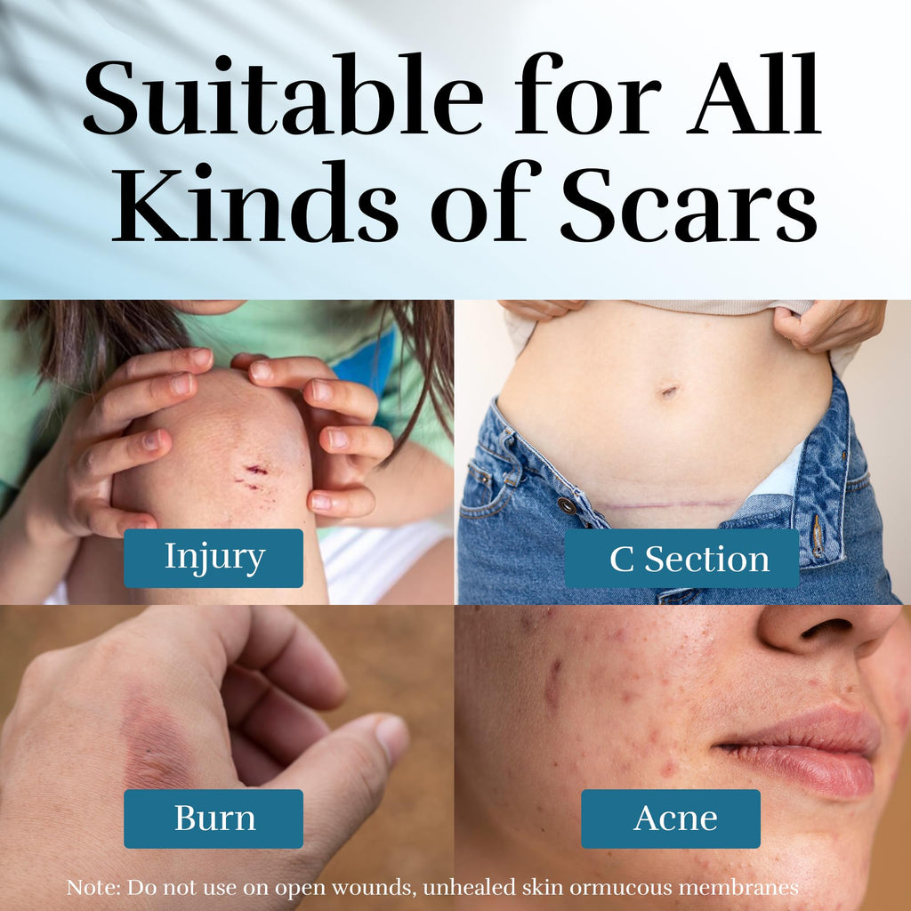 CLNABFR Silicone Scar Cream – 1.76 oz (50 g) for Scar Texture & Appearance