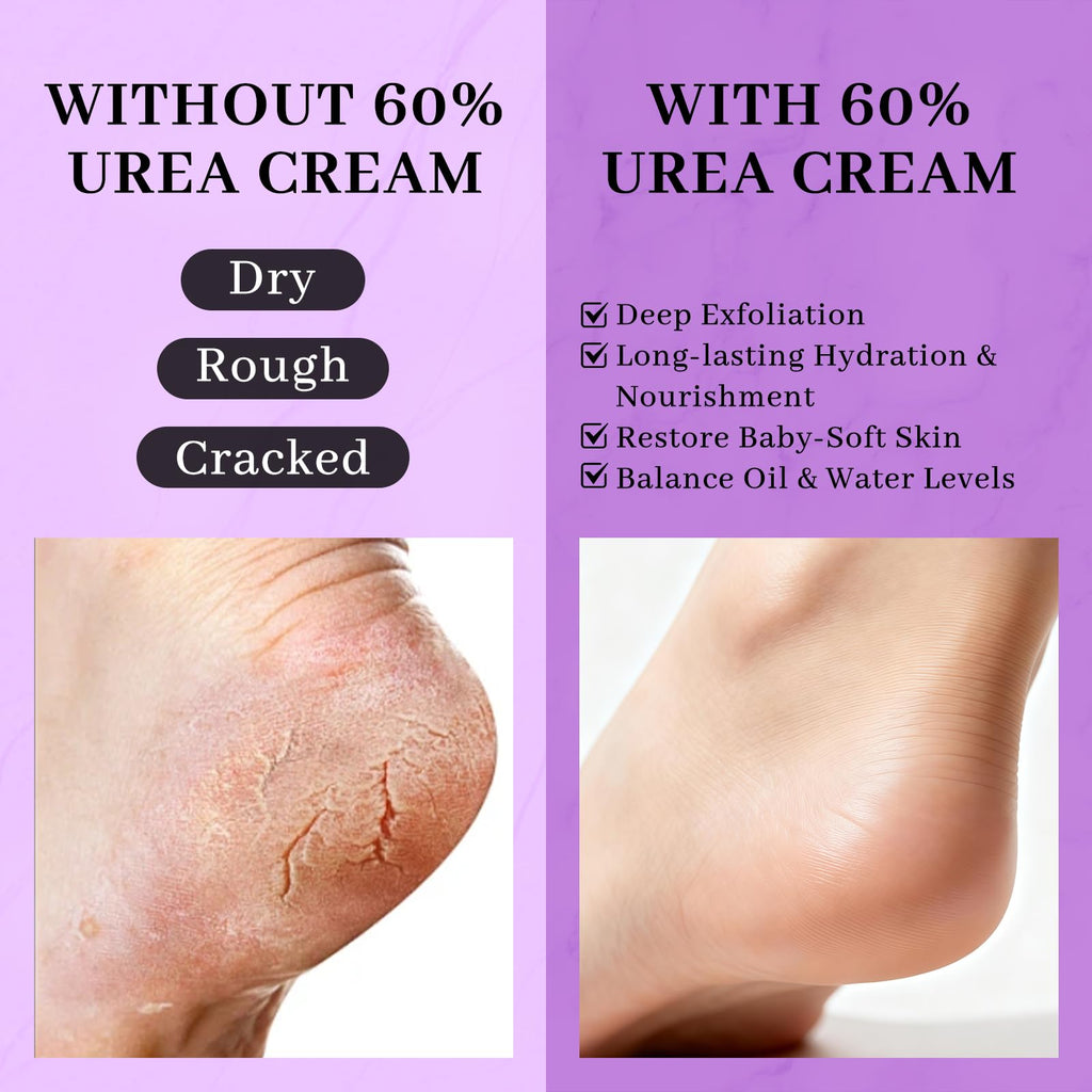 Clyecfra 5-in-1 60% Urea Cream with 2% Salicylic Acid – Maximum Strength Moisturizer for Feet & Hands (150g)