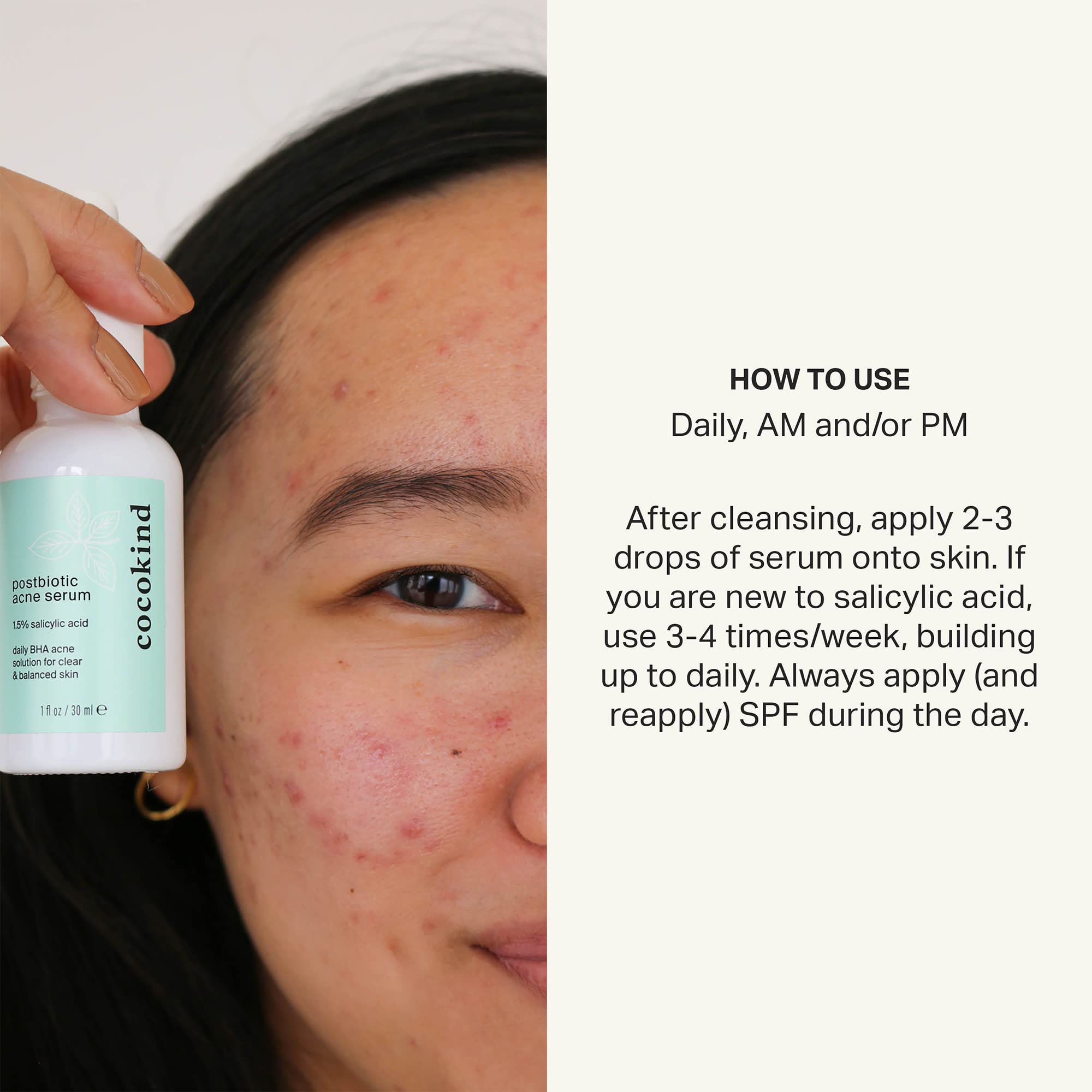 Cocokind Postbiotic Acne Serum & BHA Liquid Exfoliant – Exfoliate, Hydrate, Brighten