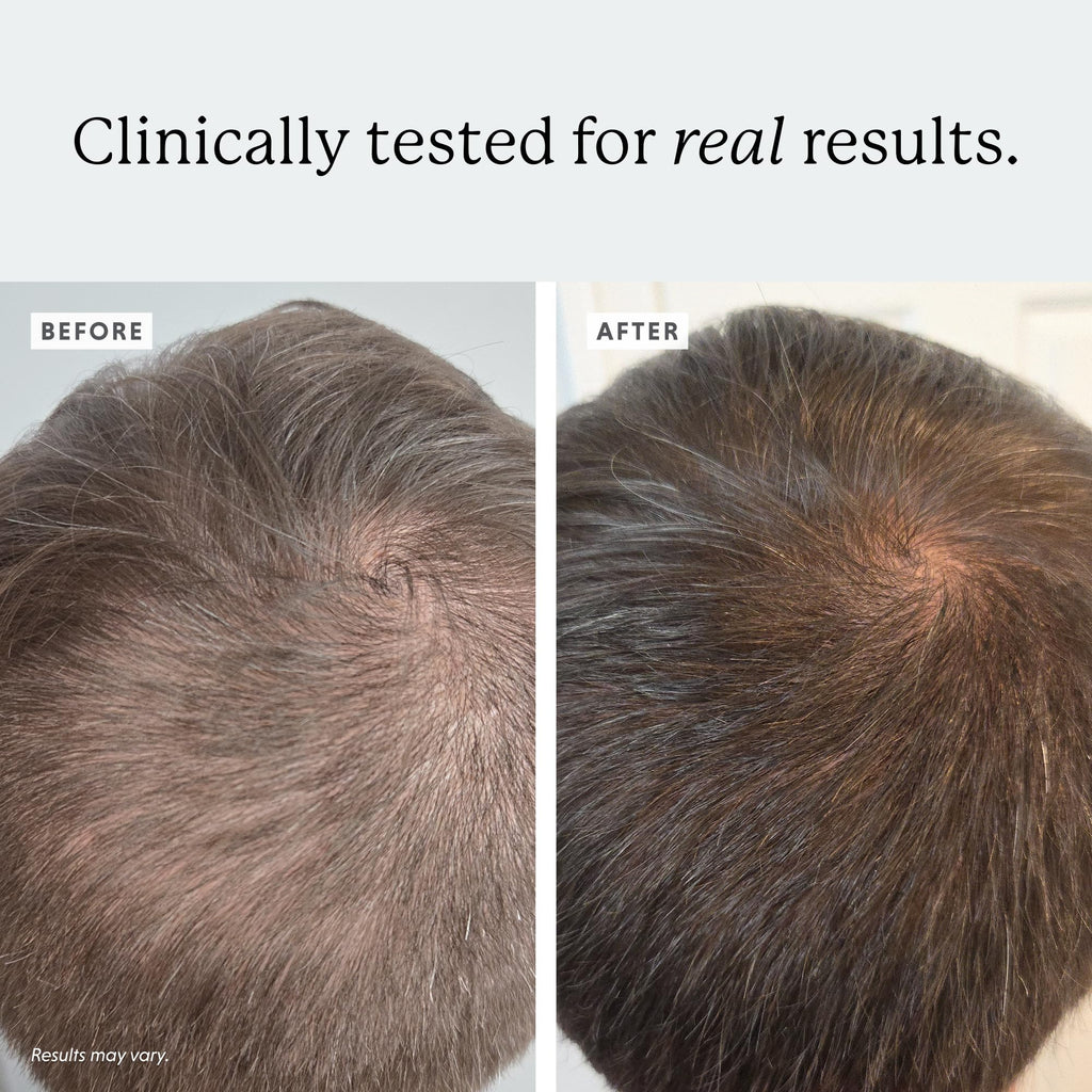 Colorsmith Densifying Scalp Serum – Procapil + Redensyl, 1 fl oz