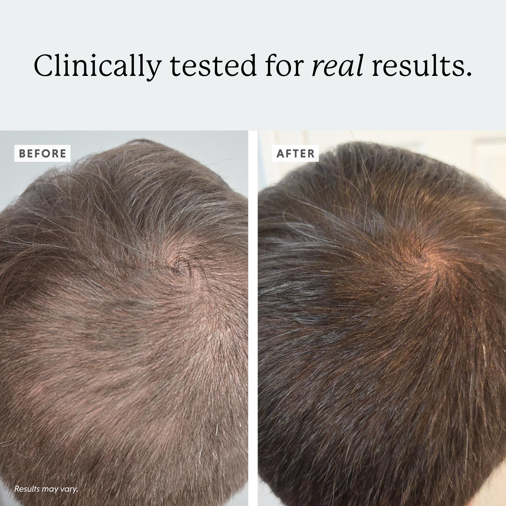 Colorsmith Densifying Scalp Serum – Procapil + Redensyl, 1 fl oz