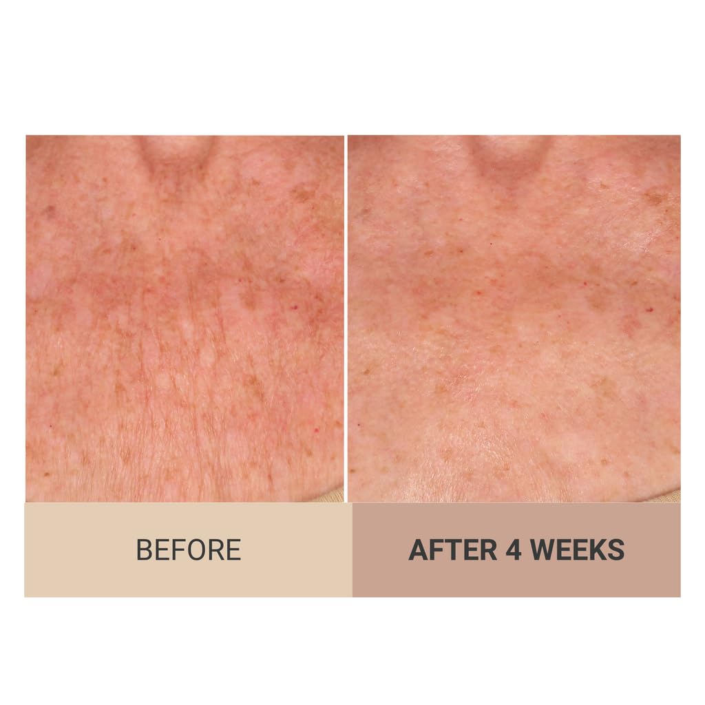 Consult Beaute Unscented Champagne Lift Hydrating Firming Body Cream with Pink PepperSlim – Tightens Crepey Skin & Hydrates Arms & Legs (8 oz)