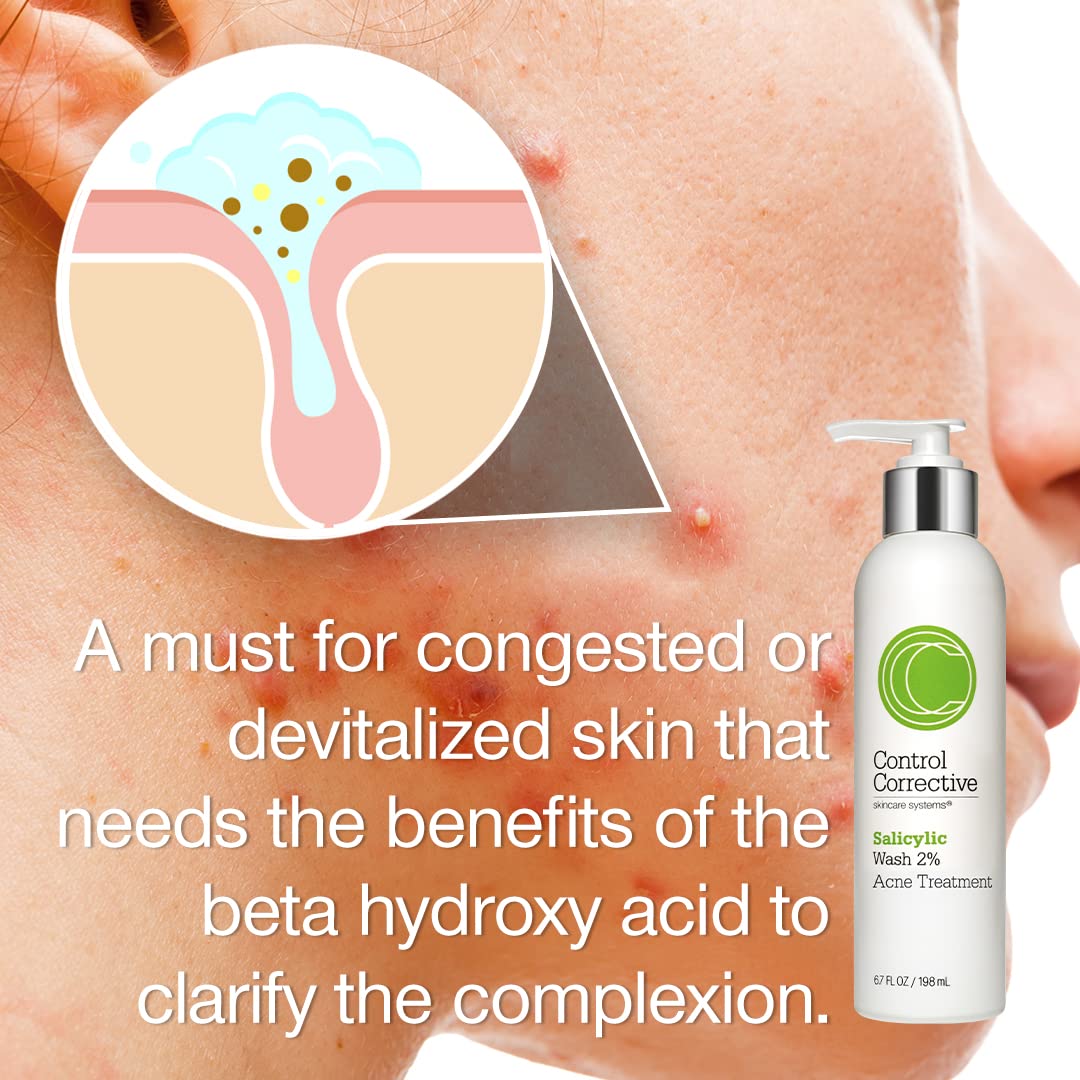 CONTROL CORRECTIVE Salicylic Wash 2% - 6.7 oz | Gentle Gel Cleanser for Oily, Acne-Prone Skin
