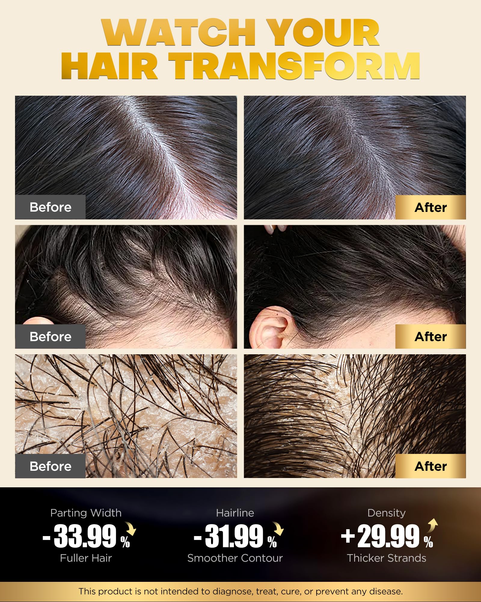 COOLKESI Tripeptide Biotin Hair Growth Shampoo & Conditioner Set – Onion Anti-Loss, Volumizing & Moisturizing Treatment