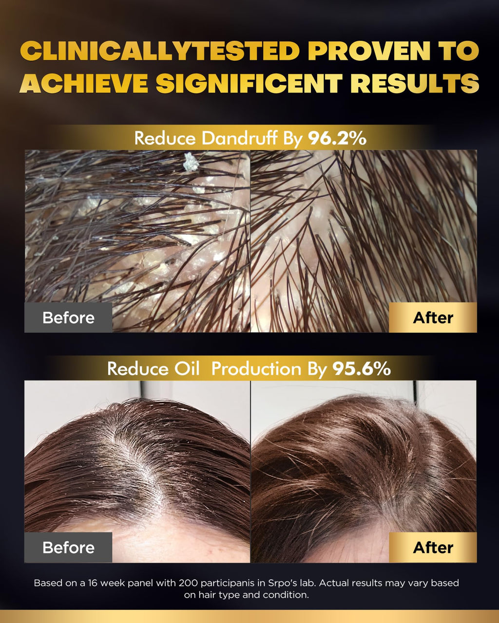 COOLKESI Tripeptide Biotin Hair Growth Shampoo & Conditioner Set – Onion Anti-Loss, Volumizing & Moisturizing Treatment