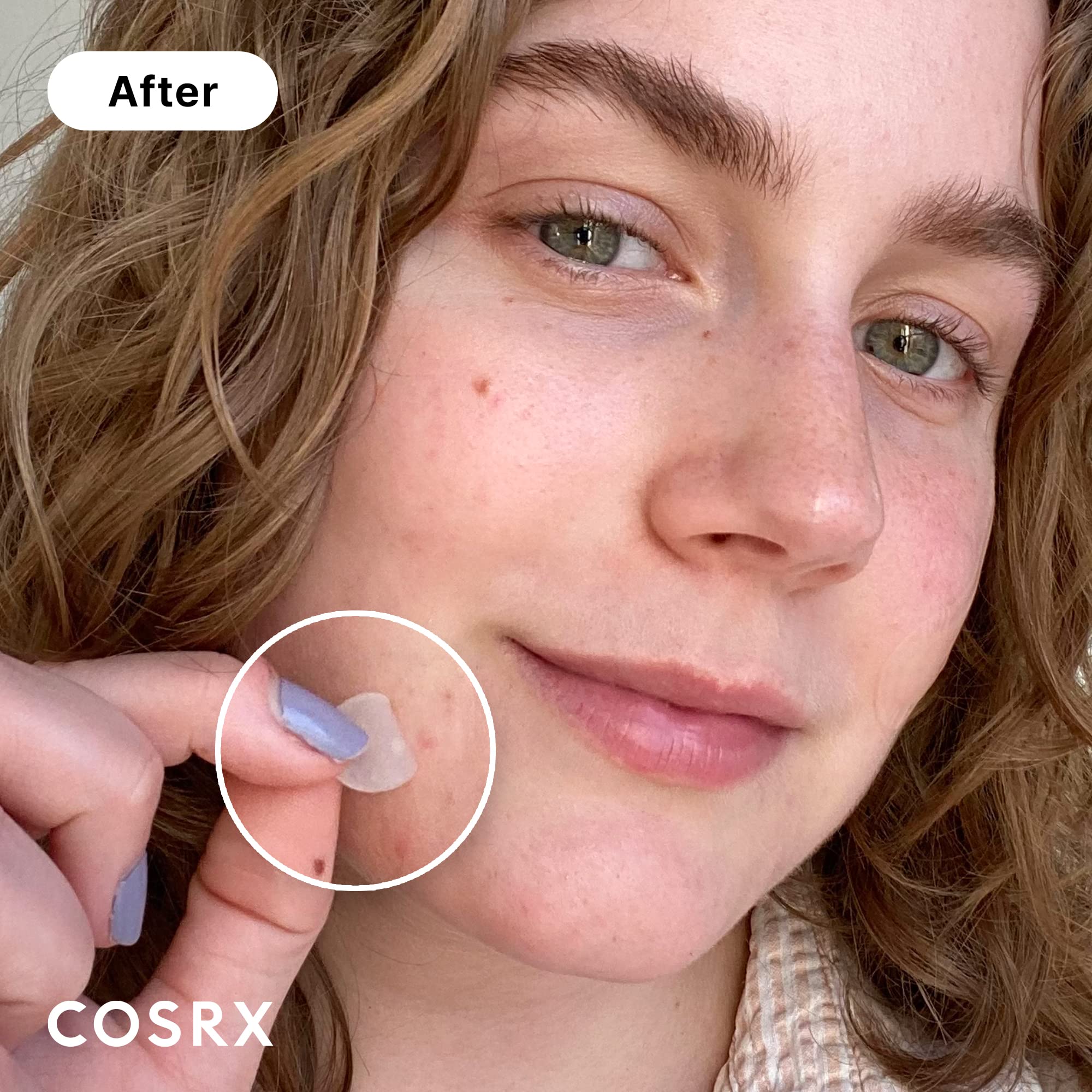 COSRX Acne Pimple Patch Original — Absorbing Hydrocolloid, 3 Sizes, 24 Patches, Animal Testing-FREE