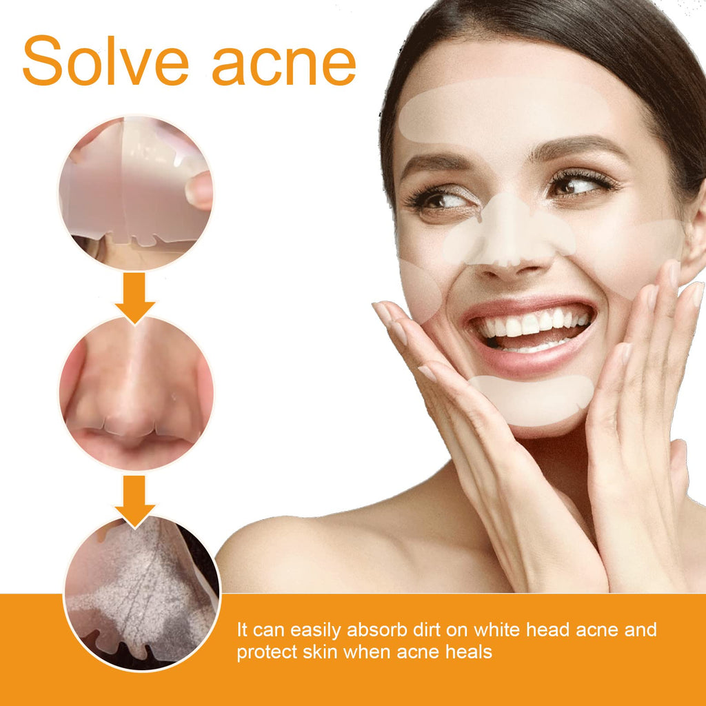 Coweroay 20PCS Hydrocolloid Acne Patches – Full-Face Spot Coverage