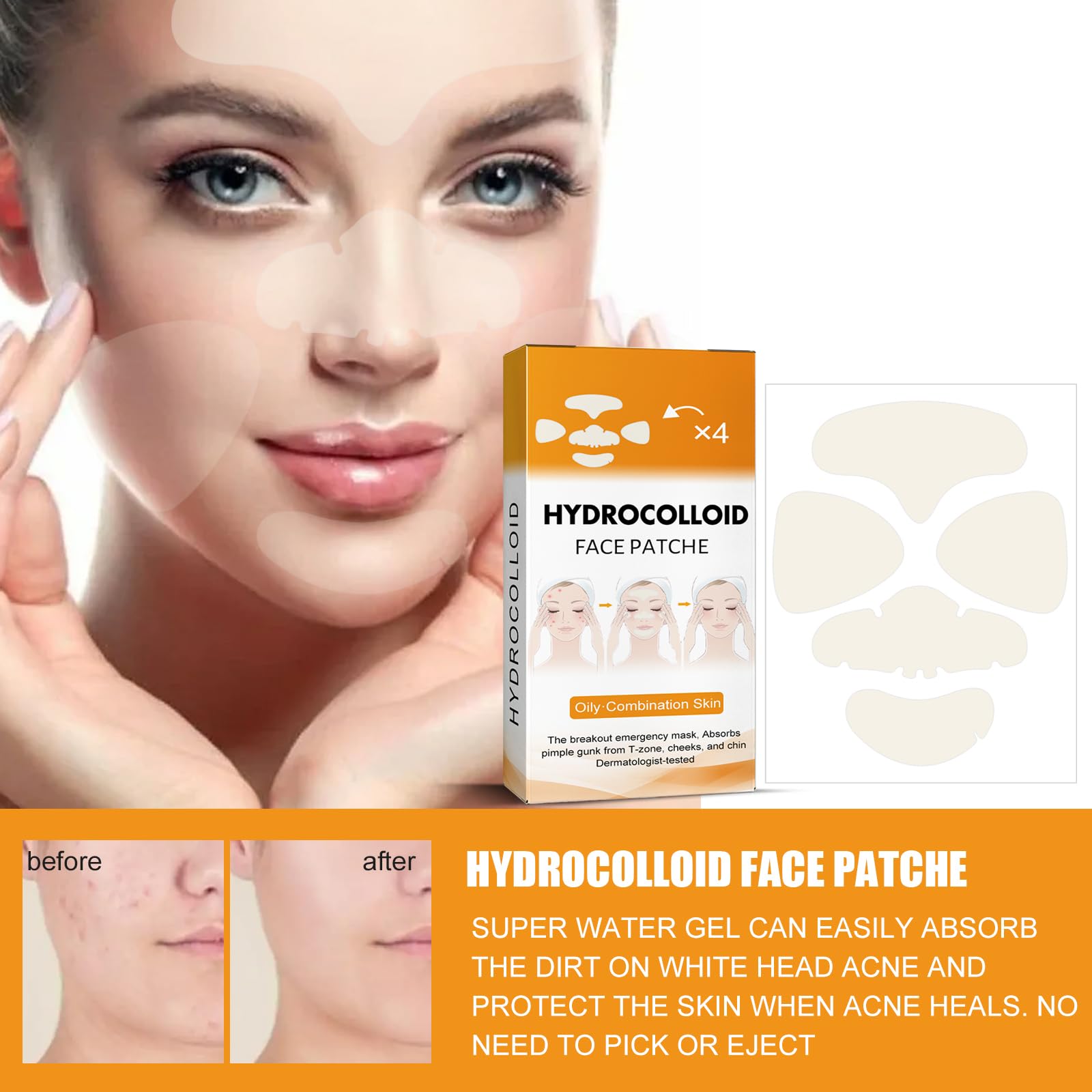 Coweroay 20PCS Hydrocolloid Acne Patches – Full-Face Spot Coverage