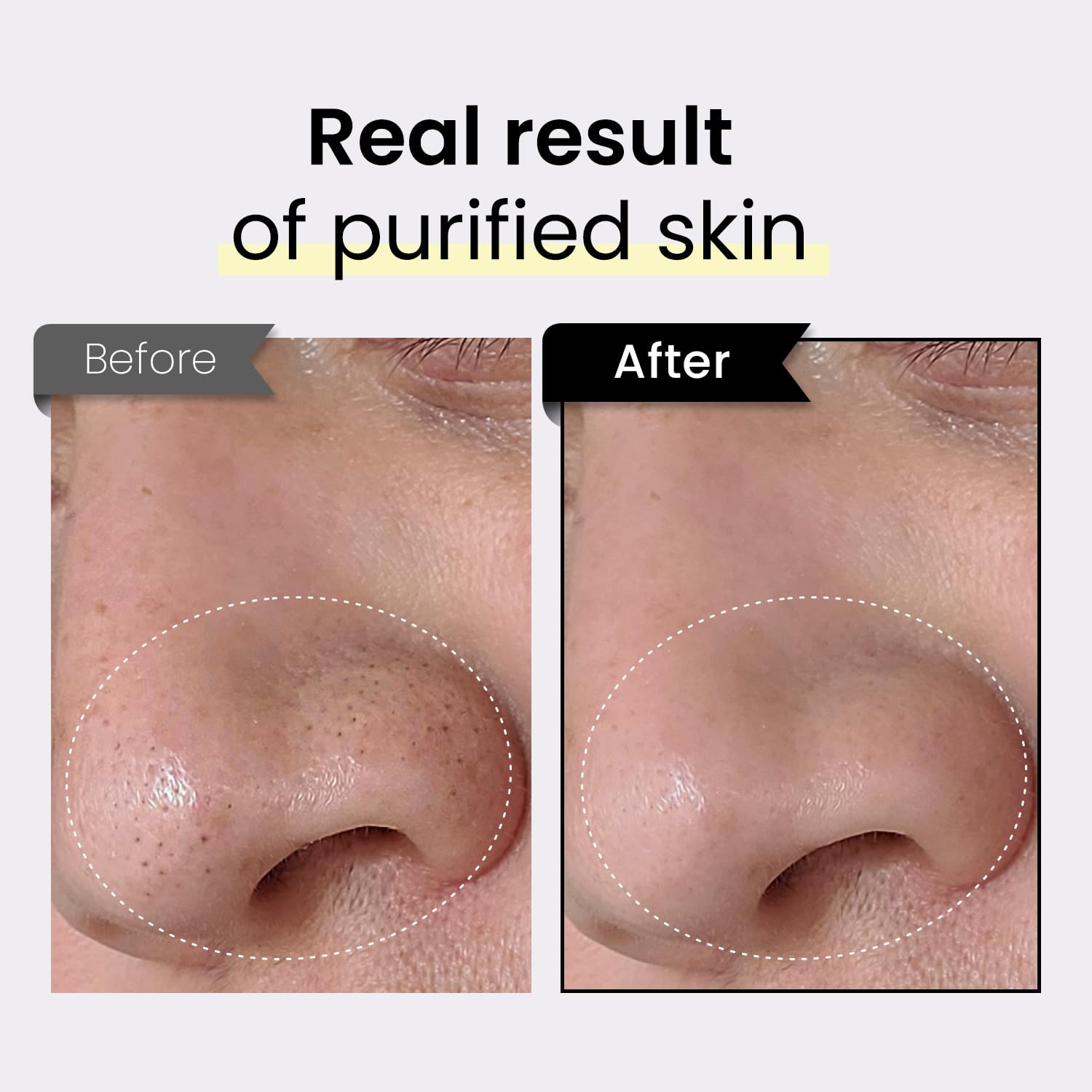 Coxir TXA Black Rice Pore Mask – 3-in-1 Wash-Off Serum for Pore Purification, Hydration & Tone | Vegan K-Beauty 50ml