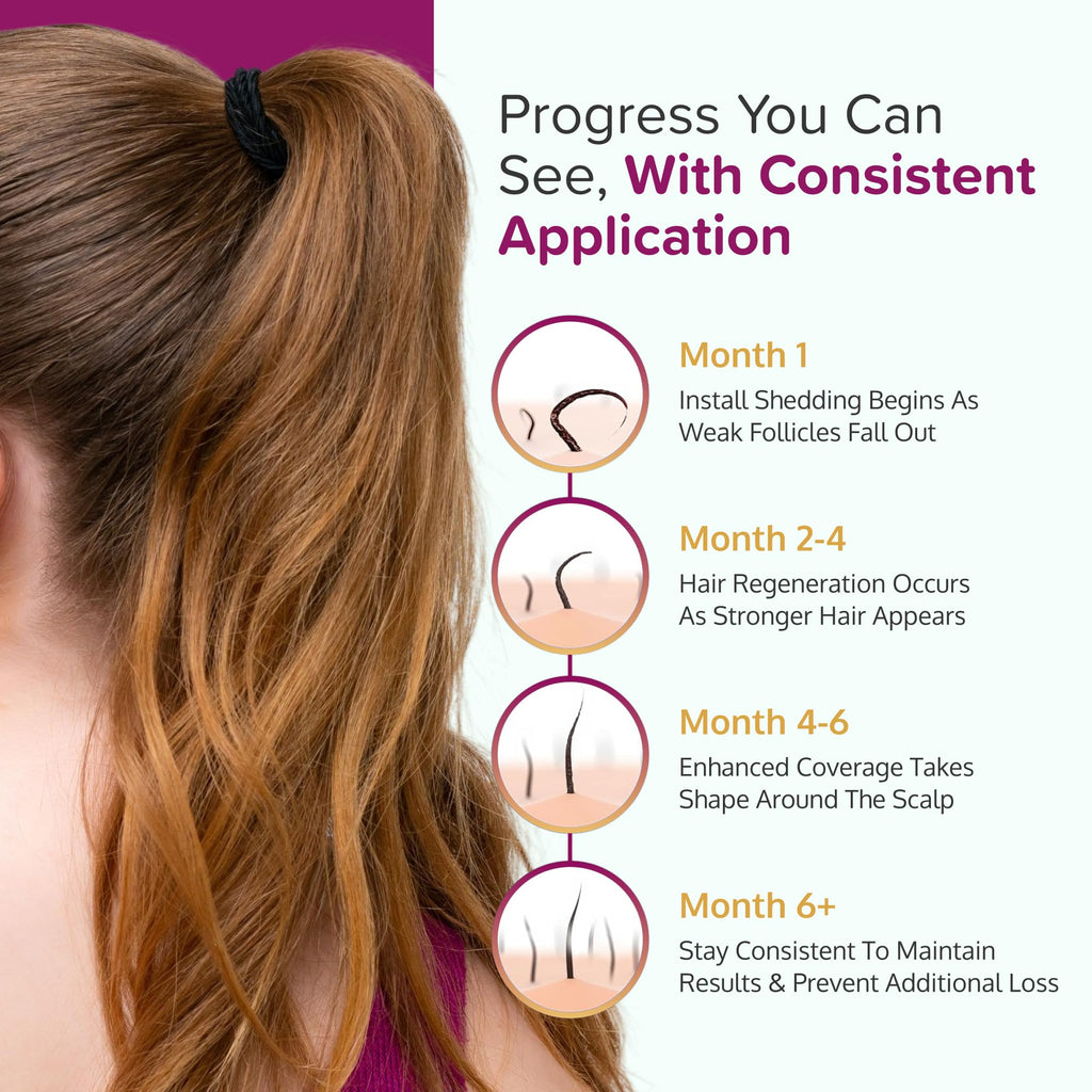 C'rcle Minoxidil 5% Foam for Women – Hair Regrowth & Thinning Hair Solution (4-Month Supply)