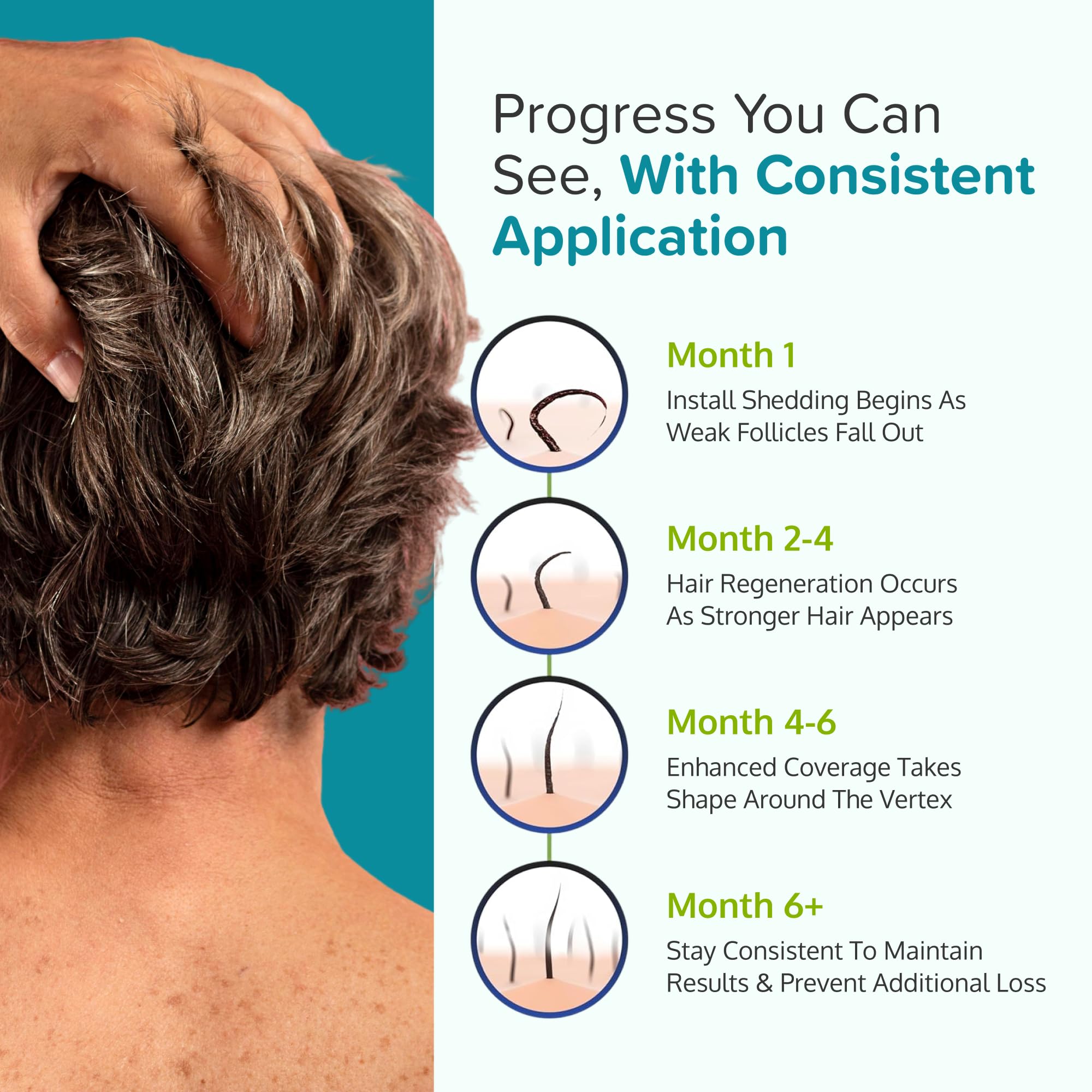 C'rcle Minoxidil for Men Foam 5% - Unscented, 6-Month Supply